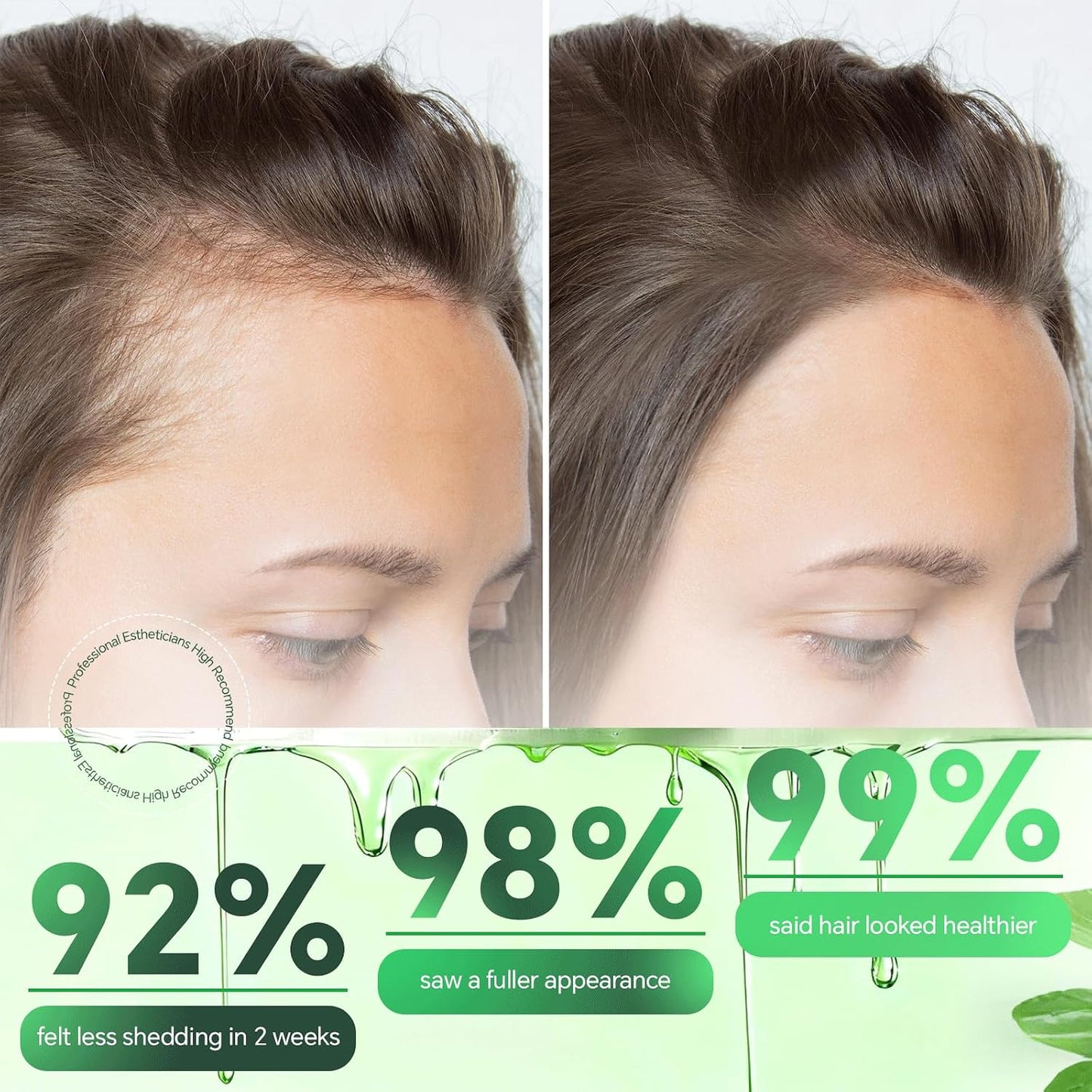 Hair Growth System - Advanced Treatment for Men & Women | Ginseng, Peppermint & Ginger for Thicker, Healthier Hair