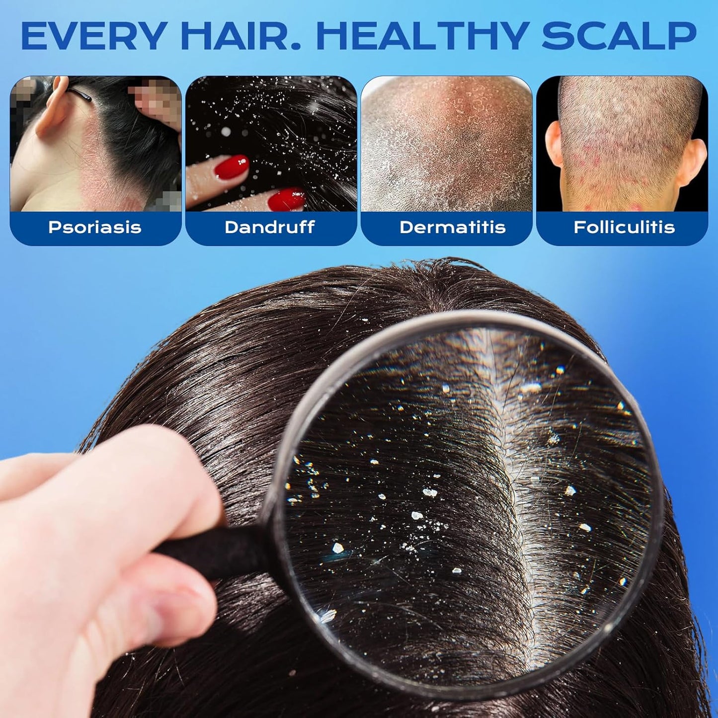 Ketoconazole Anti-Dandruff Shampoo - Scalp Treatment for Seborrheic Dermatitis & Psoriasis | Itchy Scalp Relief, Hydrating Care for All