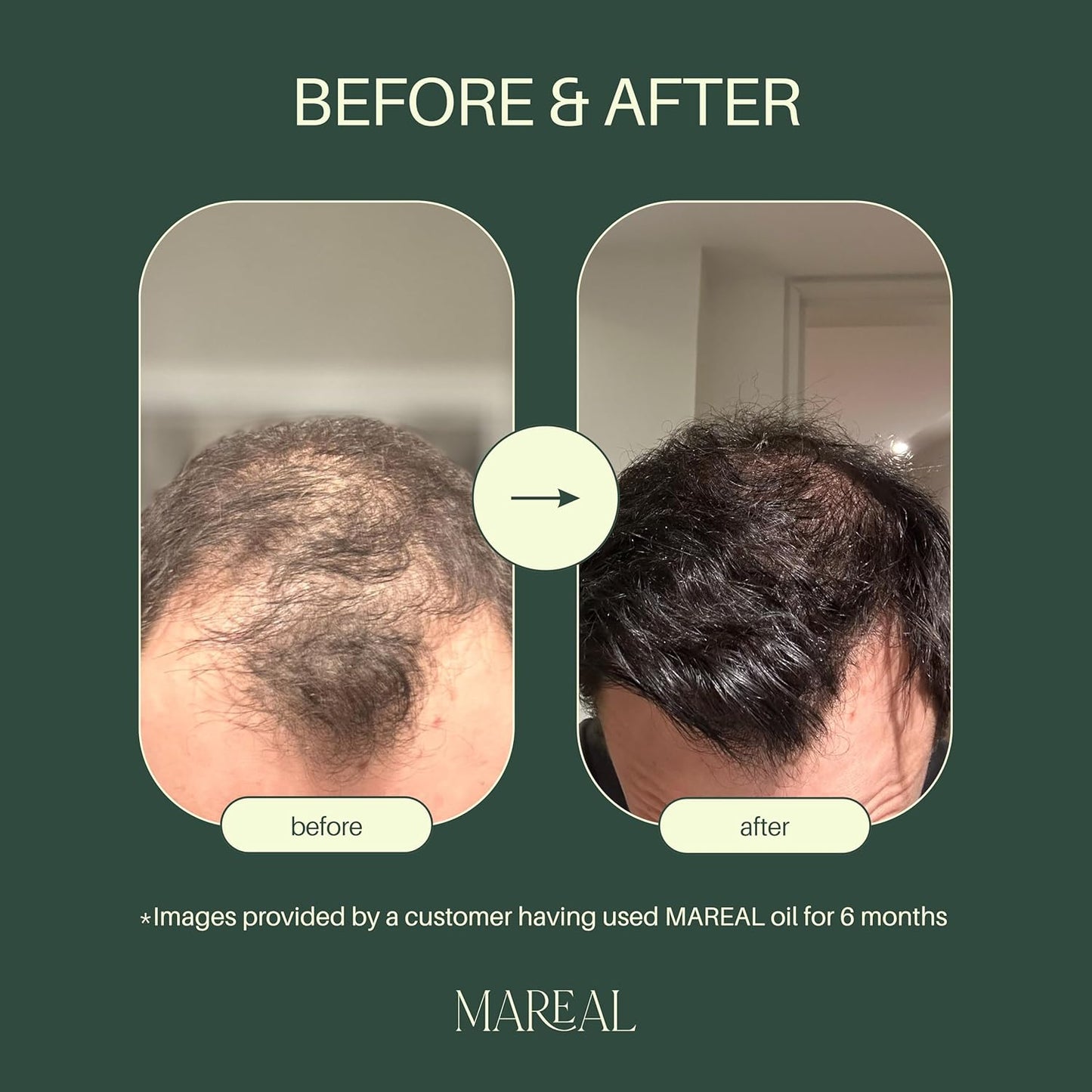Rosemary Oil for Hair Growth - Natural Scalp Treatment | Infused with Castor & Coconut Oil | 1.7 fl oz