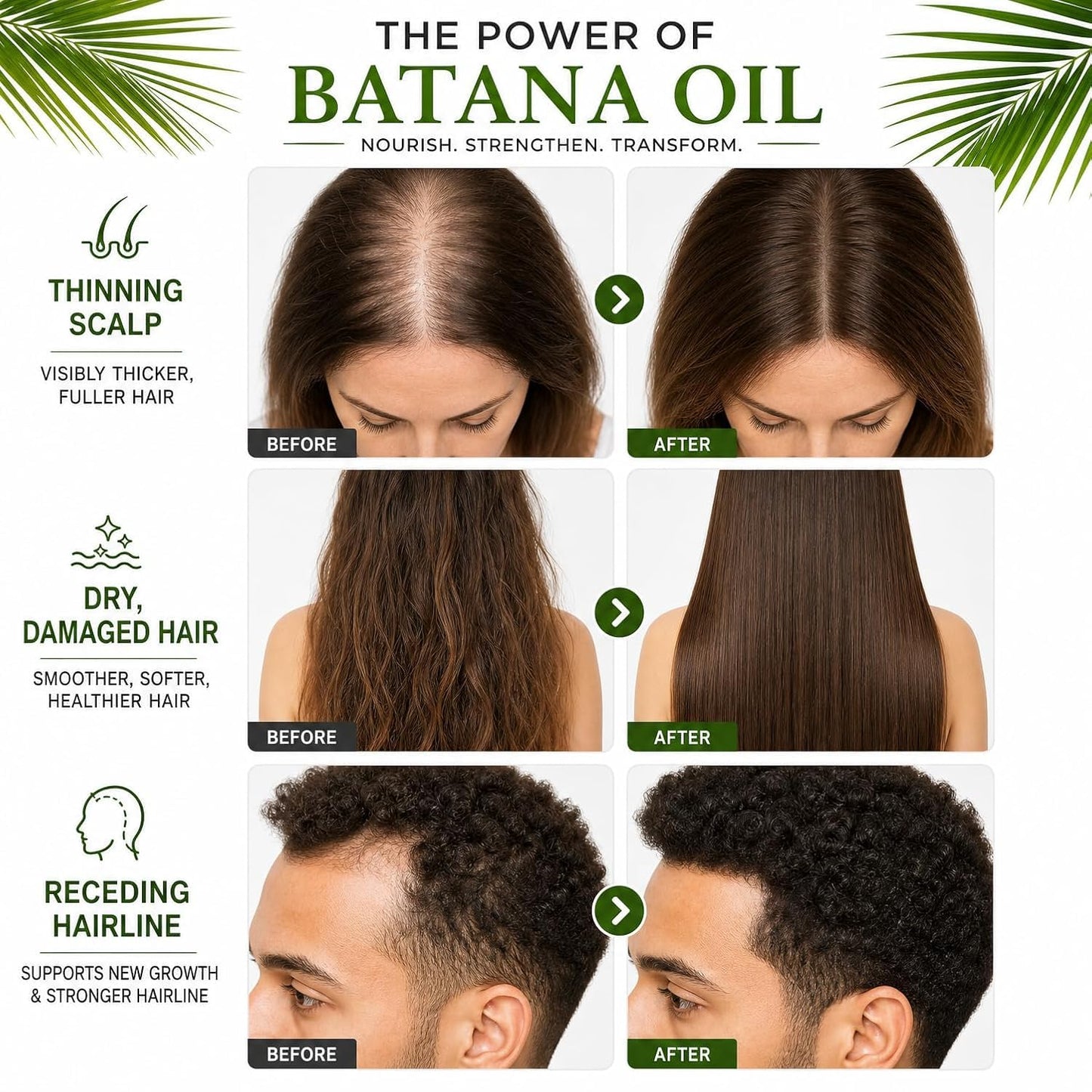 Azure Batana Oil for Hair Growth, Nature Pure Batana Oil for Hair Growth, Nourish Scalp, Repair Dry Hair, Promote Thicker Fuller Hair for Men and Women