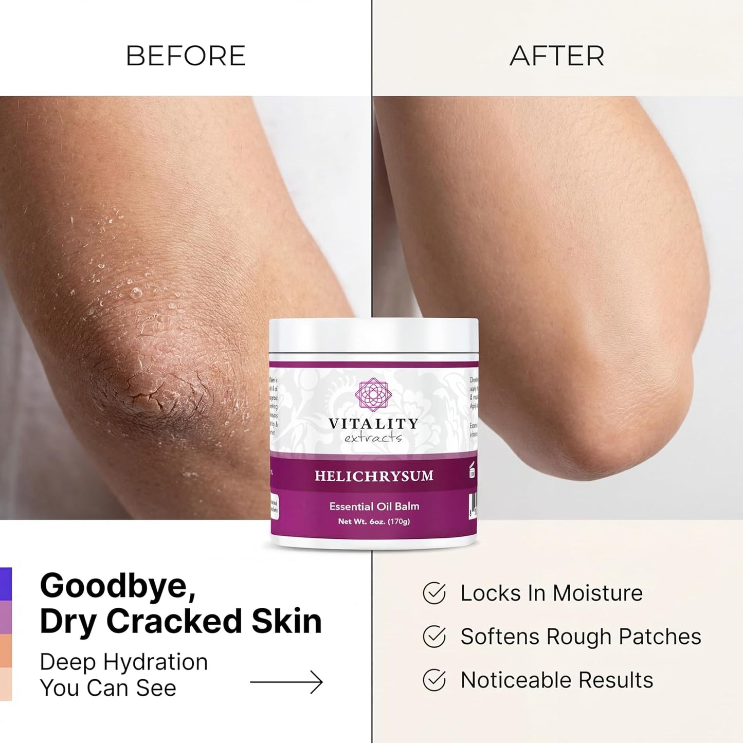 Helichrysum Balm - Ultra-Moisturizing Skin Healing Cream | 6oz, Beeswax & Almond Oil