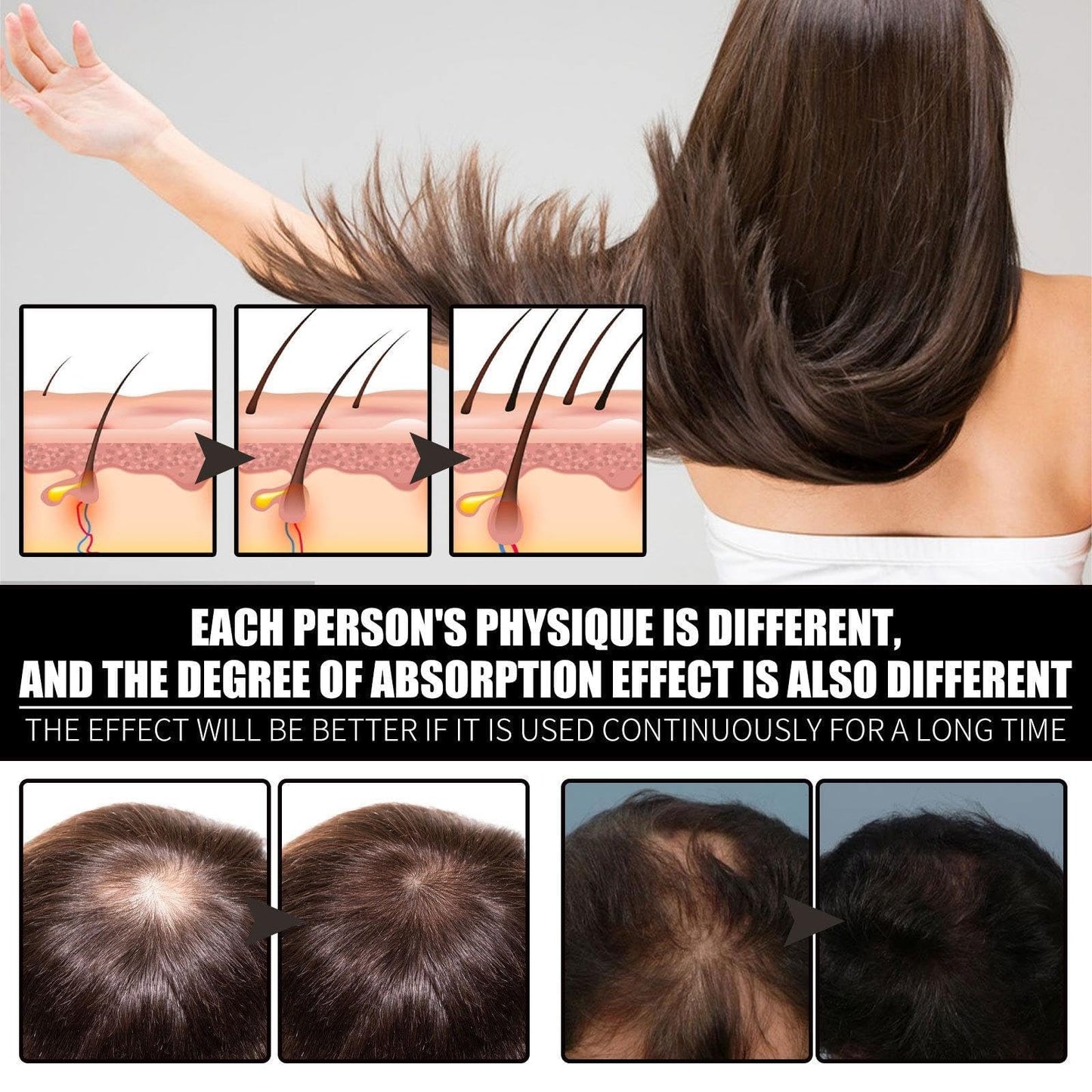 Raw Batana Oil for Hair Growth, Raw Batana Oil for Hair Growth, Strengthens, Moisturizes, Reduces Hair Fall, Scalp Oil Promotes Hair Thickness, Prevents Hair Loss for Men & Women