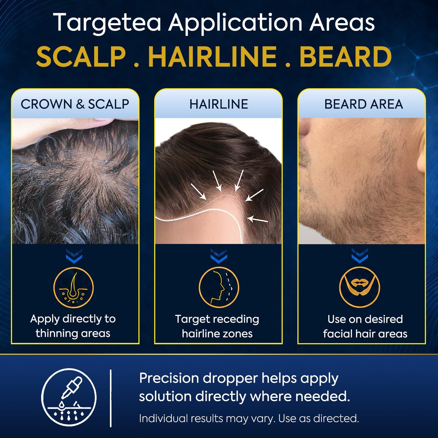 5% Minoxidil Beard Growth Kit For Men: Hair Loss and Hair Regrowth Treatments - Thicker Fuller for Facial & Scalp Hair