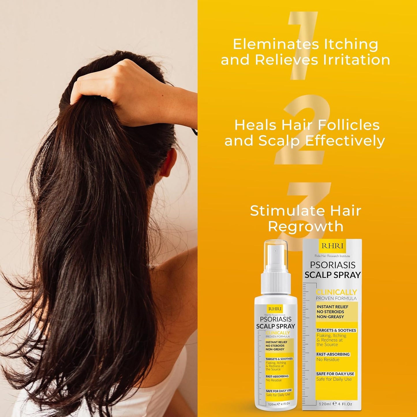 Psoriasis Scalp Spray - Antifungal Treatment for Dandruff, Yeast Infections & Flare-Ups | Soothing Relief for Itchy Scalp