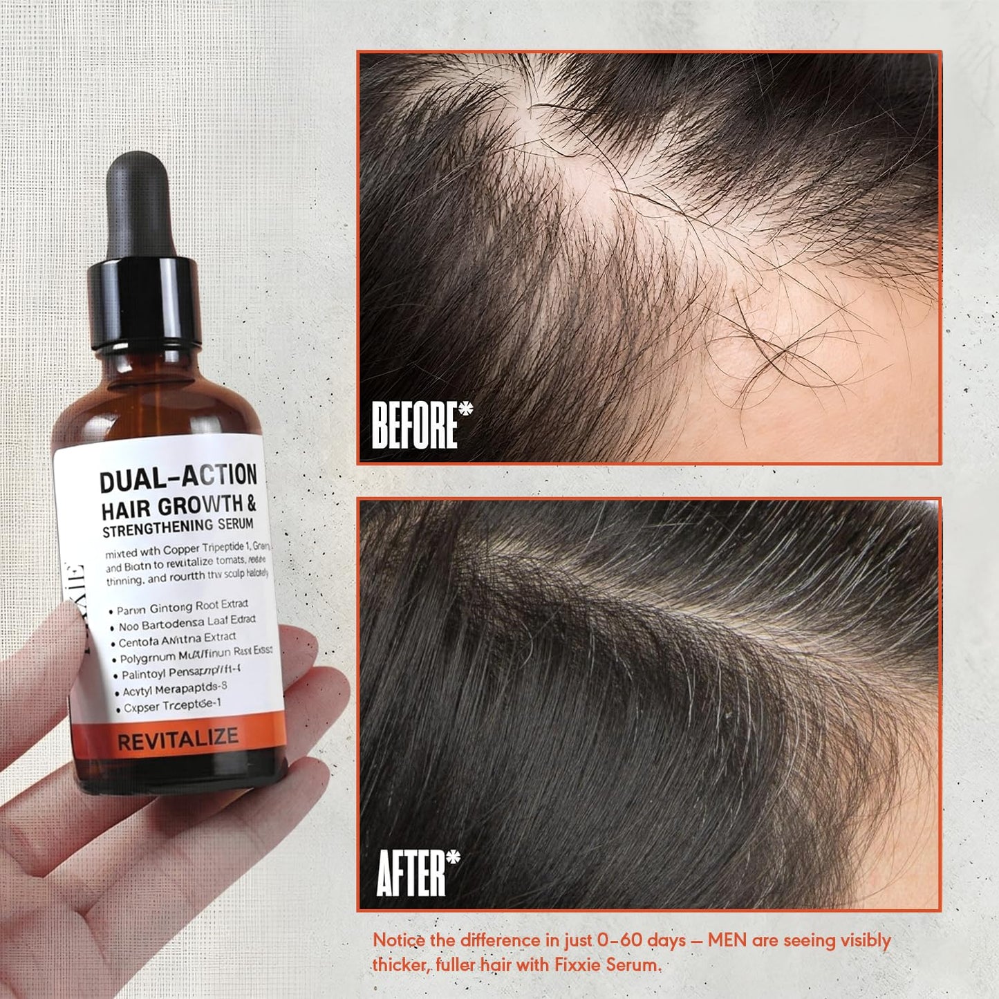 Advanced Hair Growth Serum for Men & Women – Hair Breakage Defence & Hair Density Enhancer – Multifunctional Hair Growth & Thickening Scalp Serum – Non-Greasy, Easy Absorb Formula – 60ml / 2.03 fl.oz