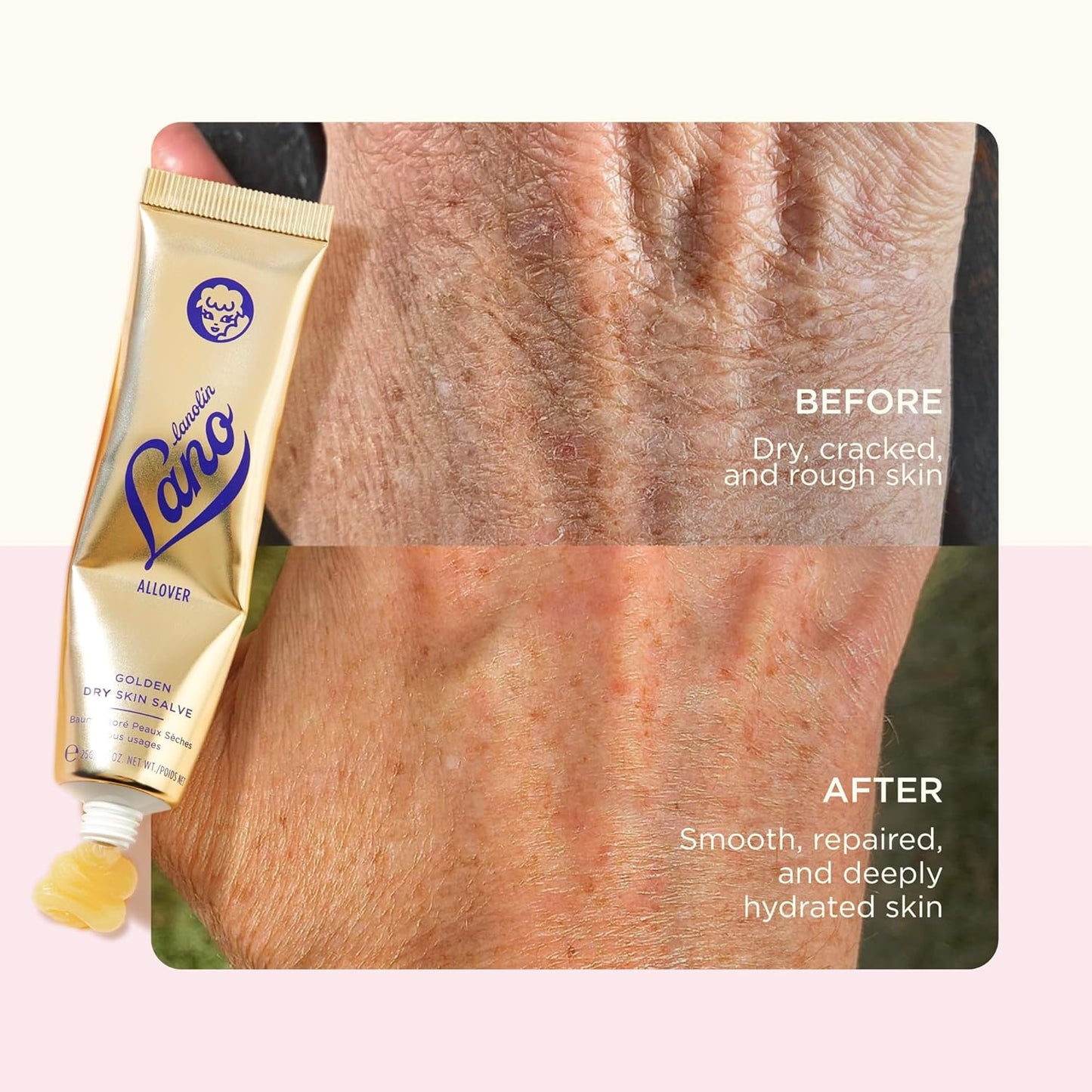 Lanolips Overnight Lip Mask & Golden Dry Skin Salve Duo | Deep Hydration & Repair - 0.52 oz & 25 g