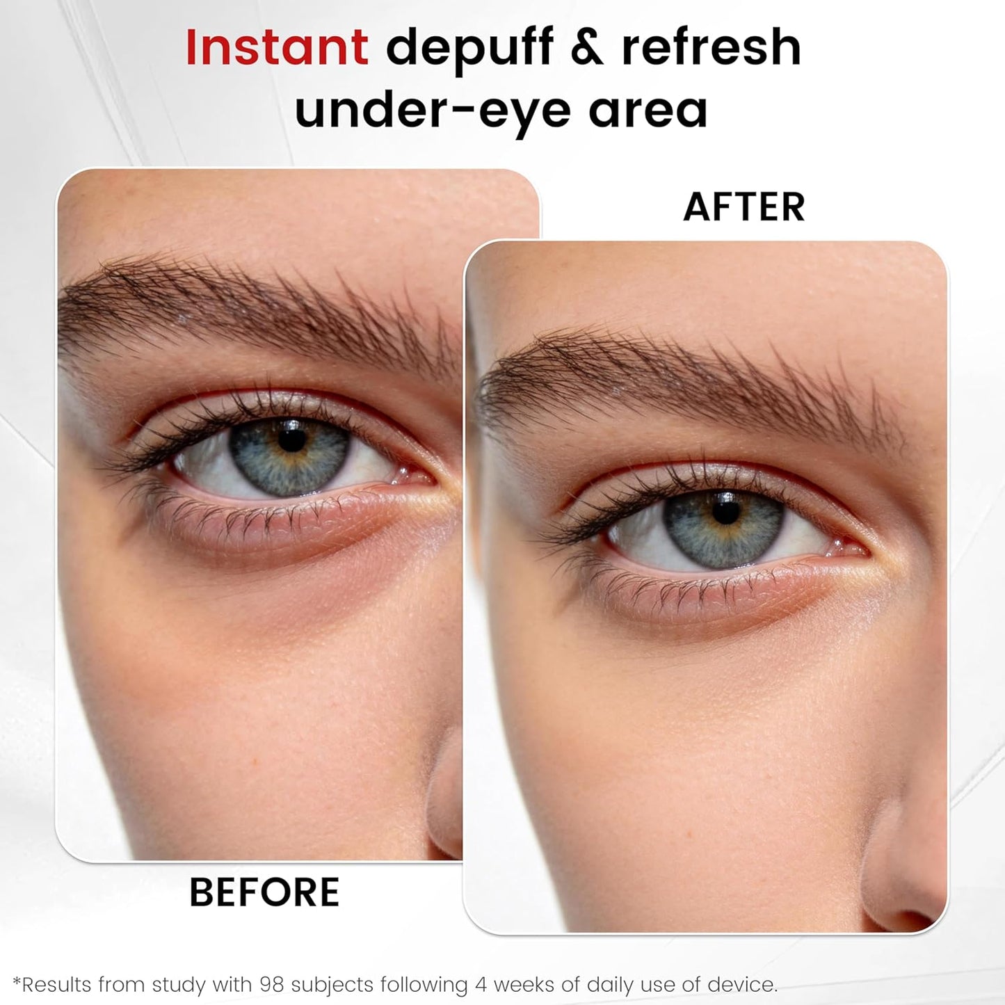 Depuffing Wand - 2-in-1 Cold & Heat Therapy for Eyes & Face | Reduce Puffiness, Dark Circles & Enhance Radiance - 3 Temperature Levels, Gentle on Skin (White)