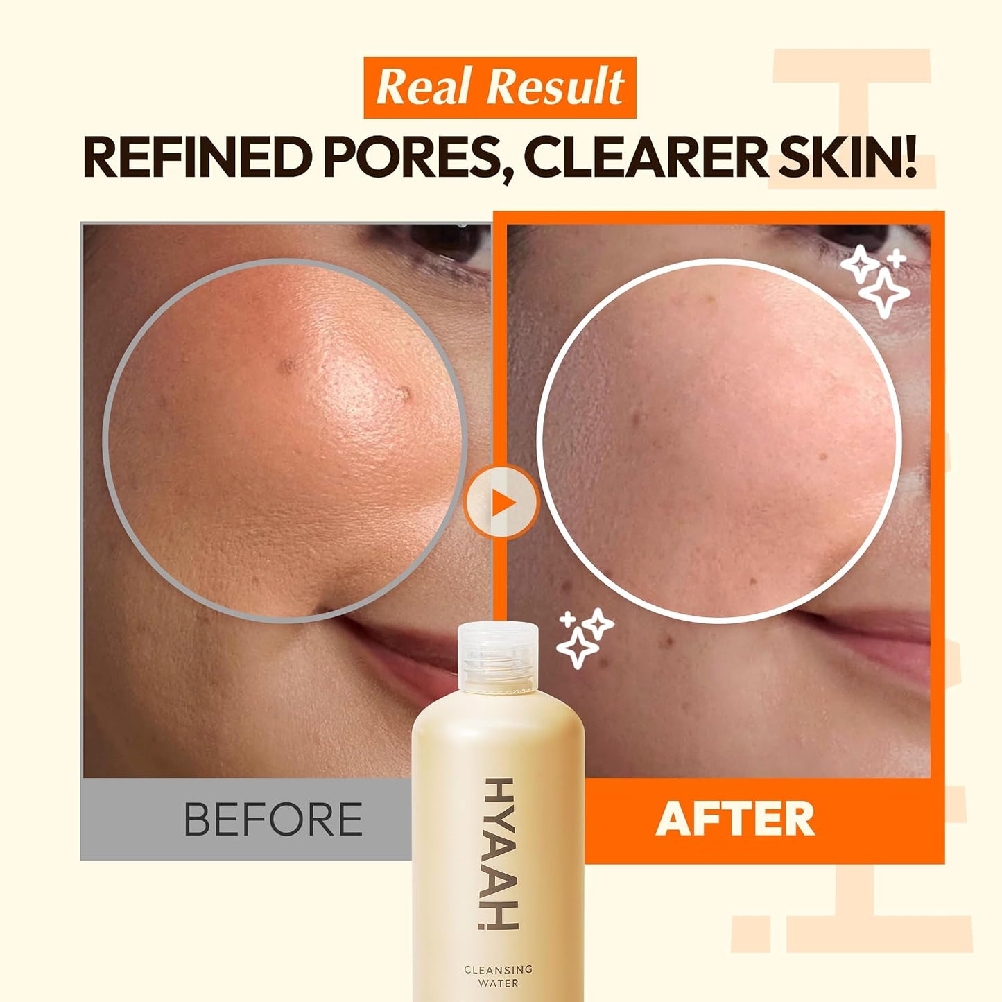 Micellar Water Makeup Remover - Oil-Free Deep Cleansing Facial Cleanser for Sensitive Skin | Hydrating & Exfoliating, 10.14 fl. oz.