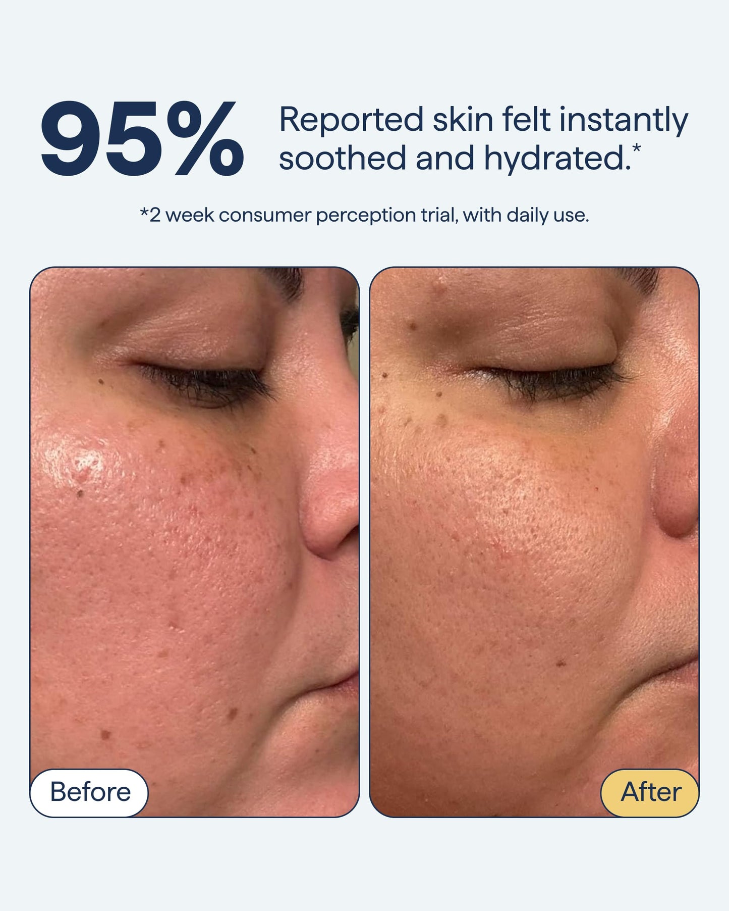 Remedy Lightweight Barrier Repairing Gel Face Moisturizer | Niacinamide, Ceramide and Squalane | Fragrance Free | Eczema Seal Certified | Water Cream All Skin Types | By Dermatologist Dr Shah | 1.7 oz