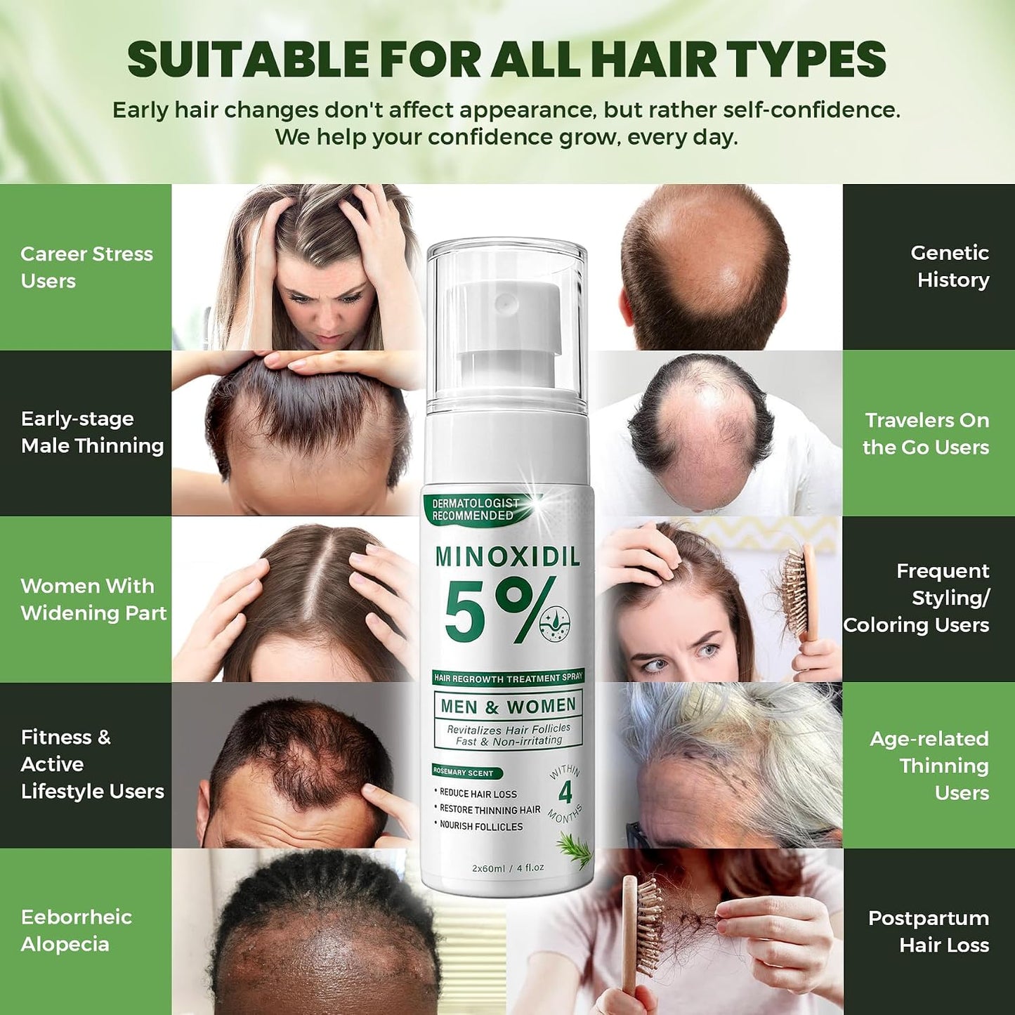 Minoxidil Hair Regrowth Spray for Men & Women - Rosemary Scent | 2 x 60ml Value Pack for Thinning Hair & Receding Hairline