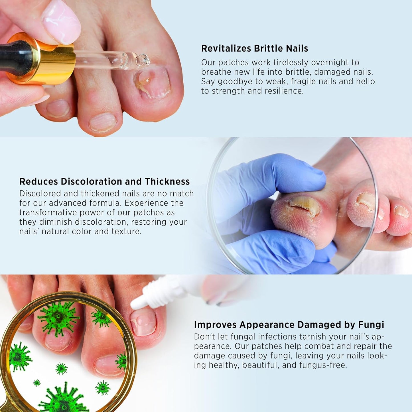 Toenail Fungus Treatment - Extra Strength Liquid & Nighttime Patches | 32 Patches + 15ml Set