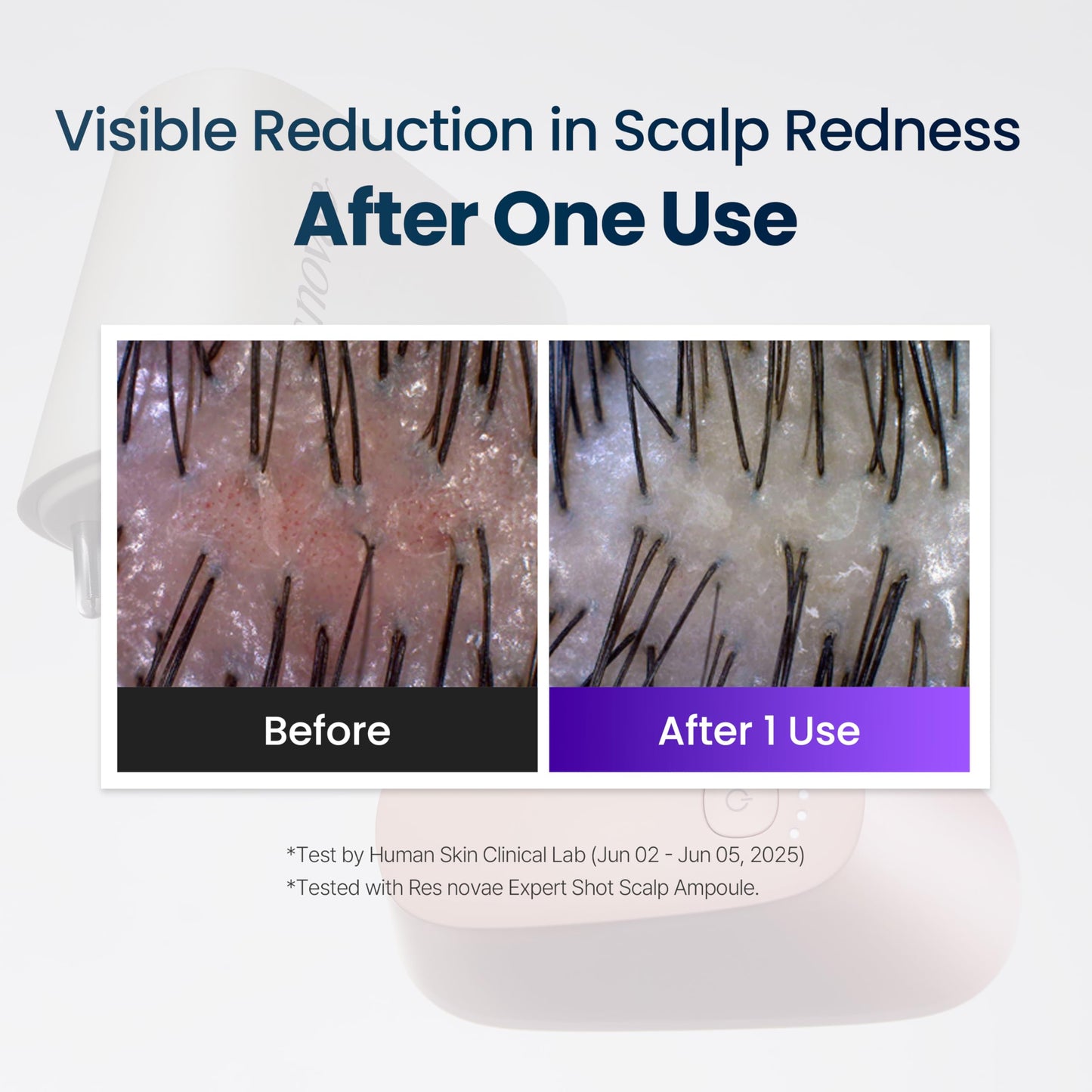 res novae Hyper Shot Scalp Care Device(Sunset Pink), Supports Ampoule Absorption, Scalp Vitality and Daily Scalp Massage at Home