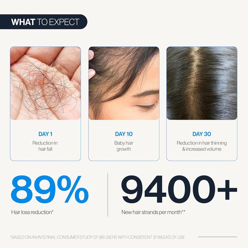 Hair Growth Serum Roll-On - 5% Saw Palmetto & 3% Rosemary Oil | Hair Regrowth for Men & Women - 25ml