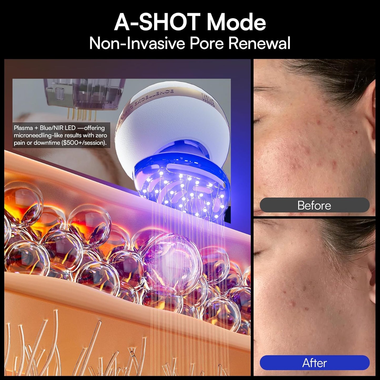 INIA SPHERA 8-in-1 Microcurrent Facial Device - Red Light & Cooling Tool for At-Home Skin Care | 5 Custom Modes