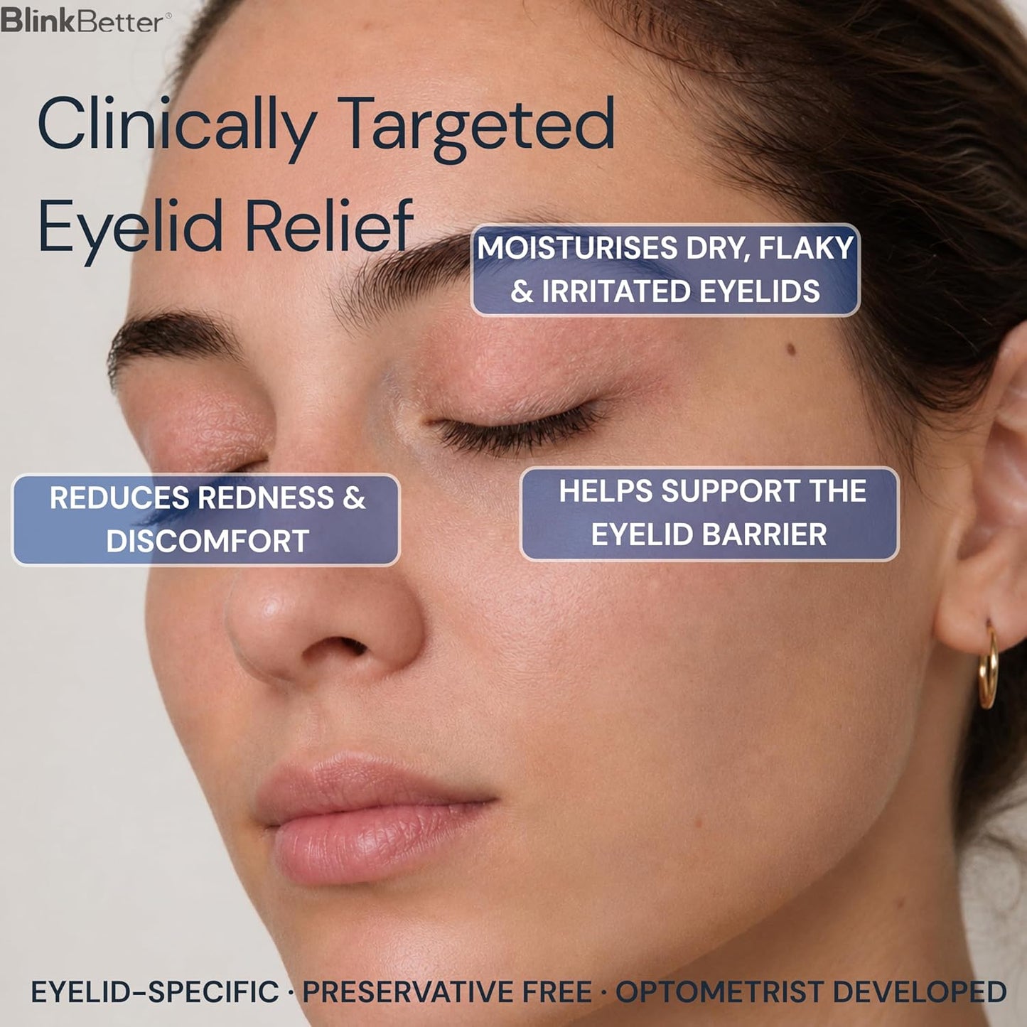 BlinkBetter Eyelid Ointment - Deep-Moisturizing Oat Complex with Shea Butter & Panthenol for Dry, Itchy Eyelids | 0.34 oz