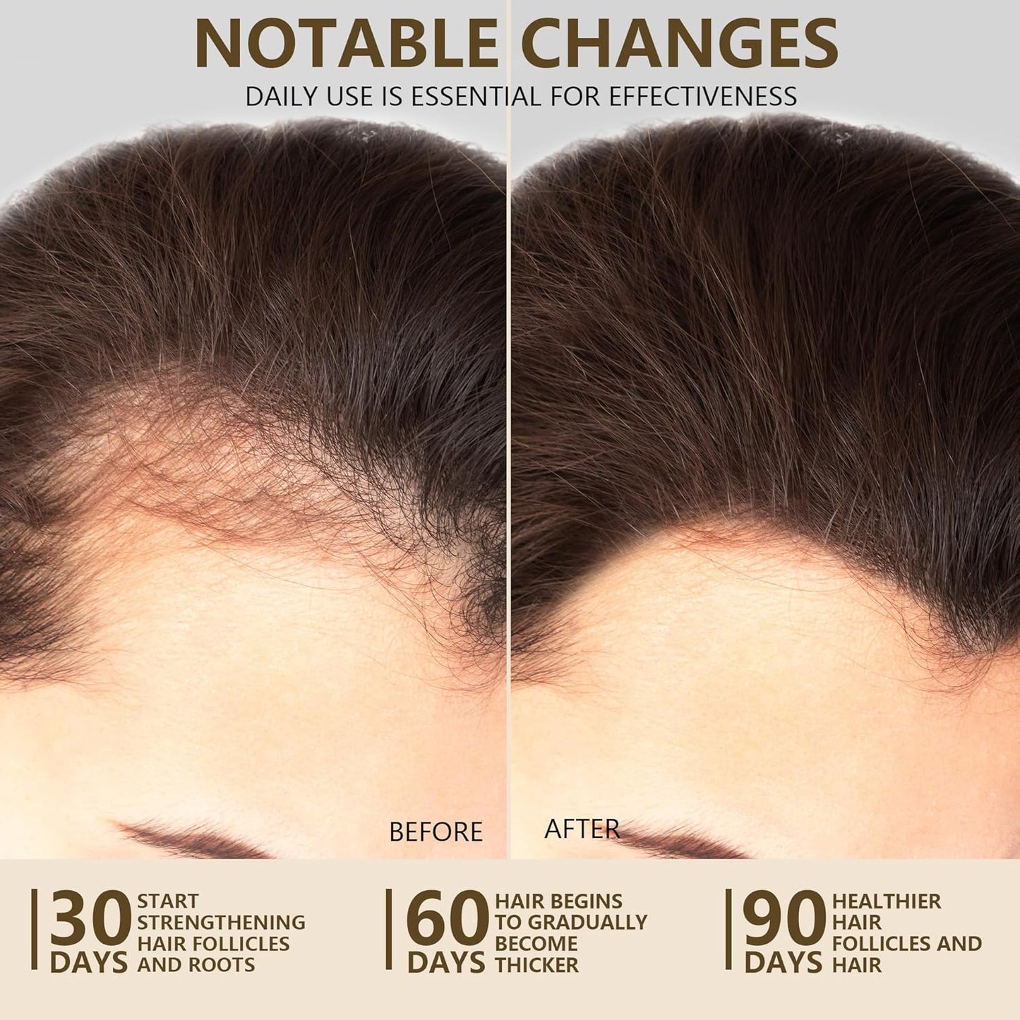 Raw Batana Oil for Hair Growth - 100% Natural & Organic, Prevents Hair Loss | 5.07 Fl Oz