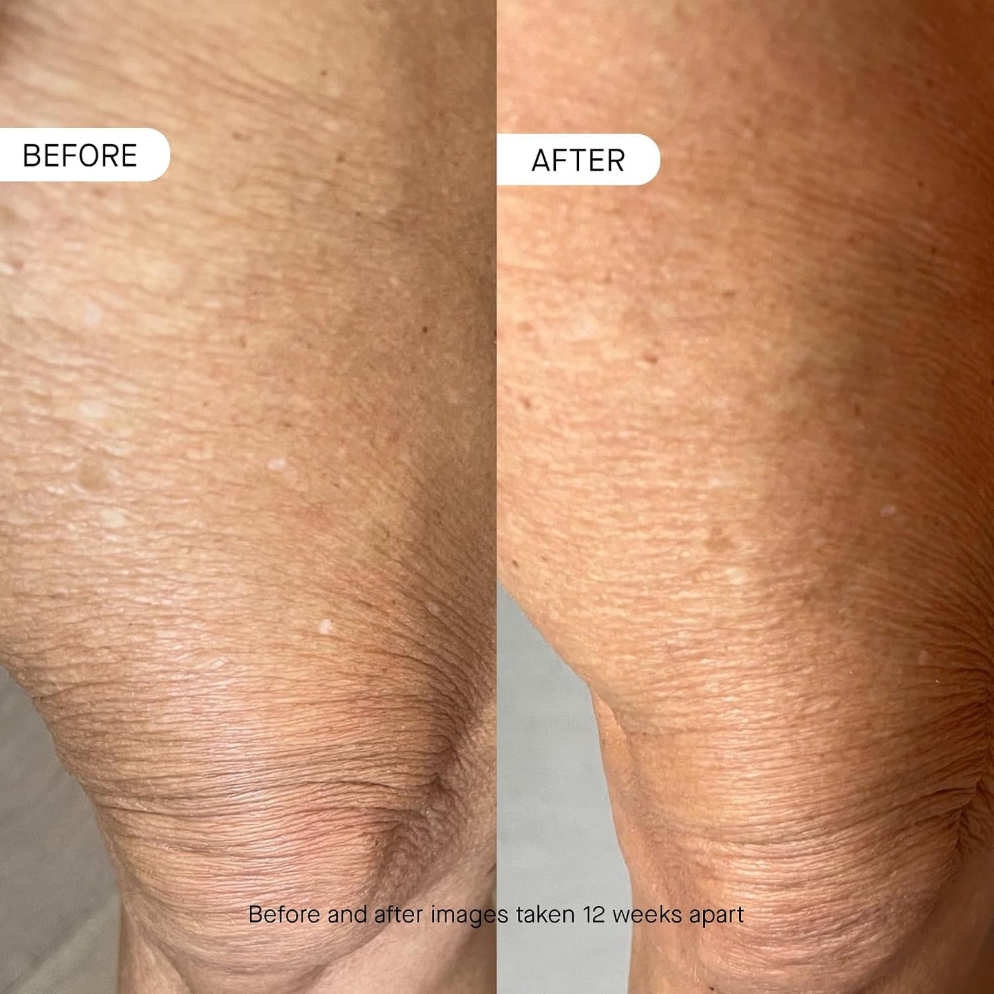 OneSkin BODY OS-01 Peptide Moisturizer - Age Reversal & Skin Longevity | Fragrance-Free, 250 mL / 8.45 oz