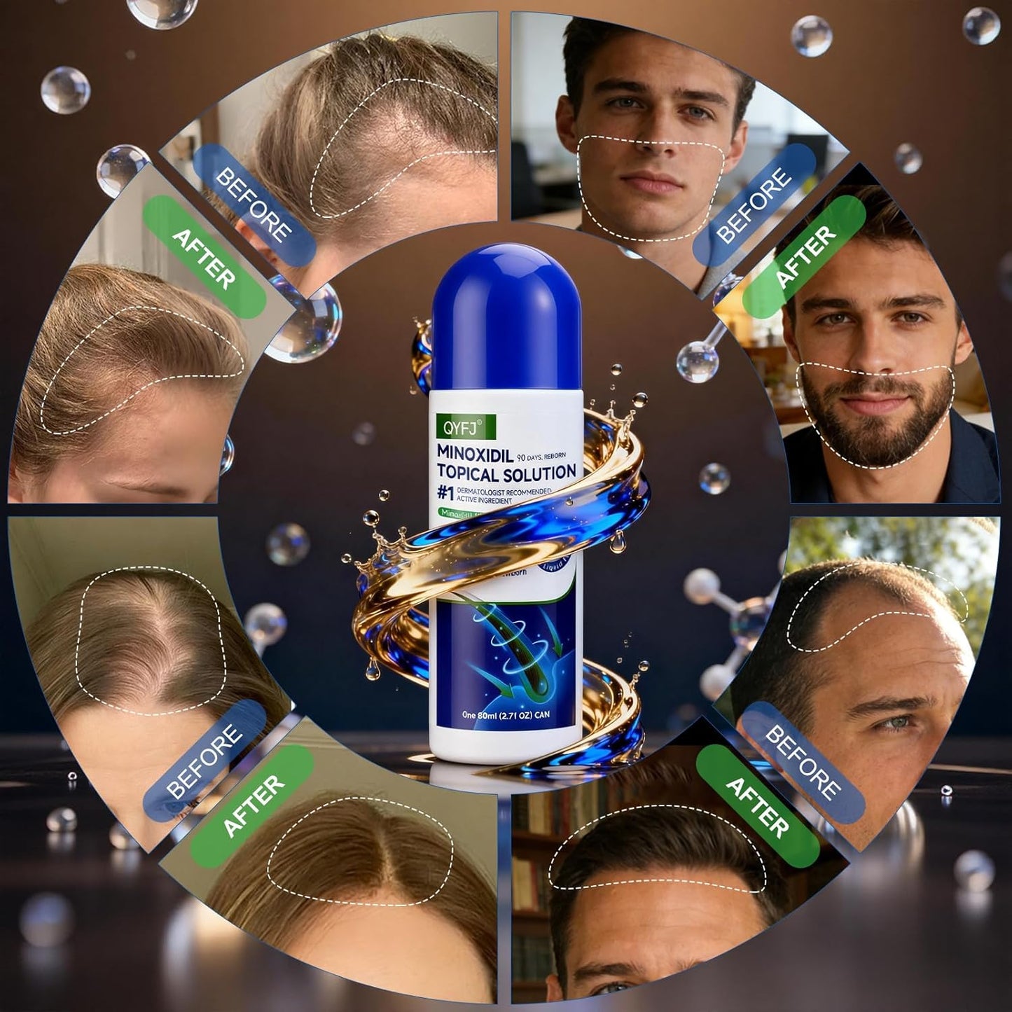Minoxidil Hair Growth Serum for Men & Women - Biotin-Infused | 3 Pack, 4-Month Supply, 2.7 FL OZ Each