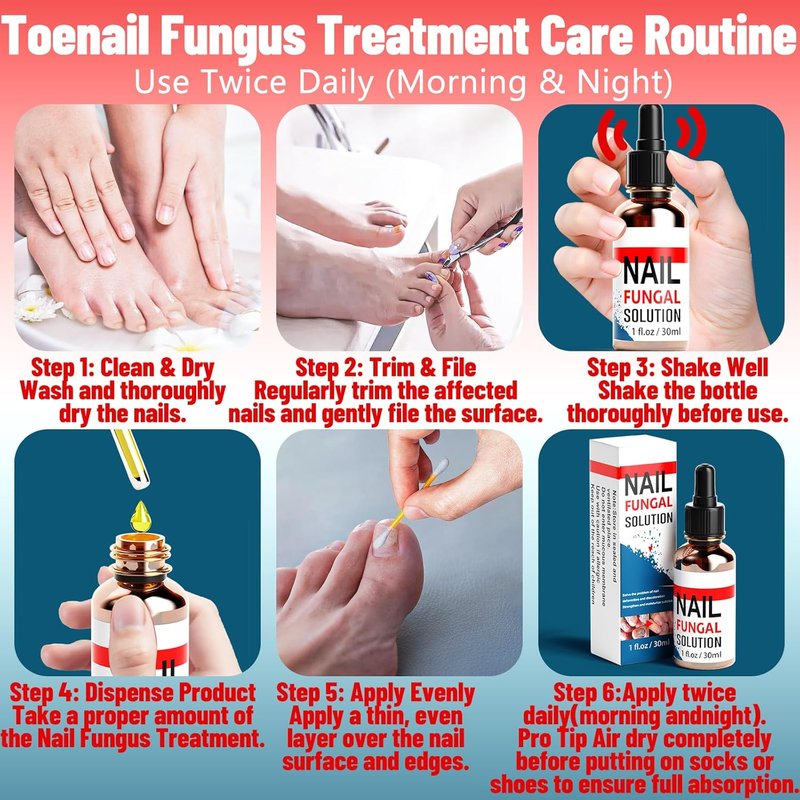 Toenail Fungus Treatment - Extra Strength 25% Undecylenic Acid | Gentle Plant-Based Formula, 1.01 Fl. Oz (Blue)