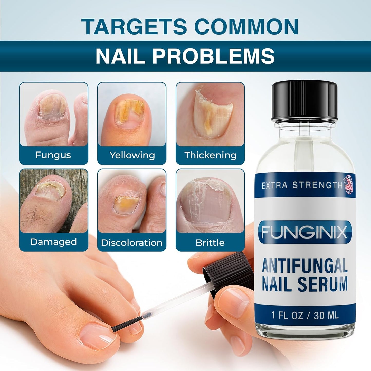 Fungus Treatment - Extra Strength Solution for Toe, Finger & Foot Fungus | Made in the USA (1 Bottle)