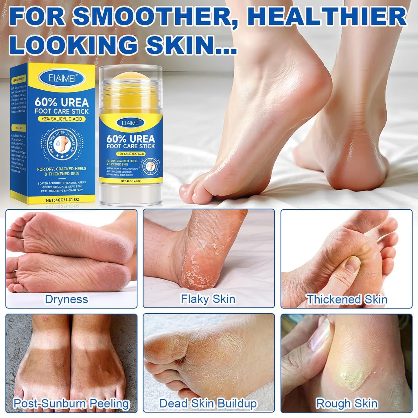 Intensive Repair Foot Stick - 60% Urea & 2% Salicylic Acid for Dry Cracked Heels | Fast Relief for Rough Skin, 2-Pack