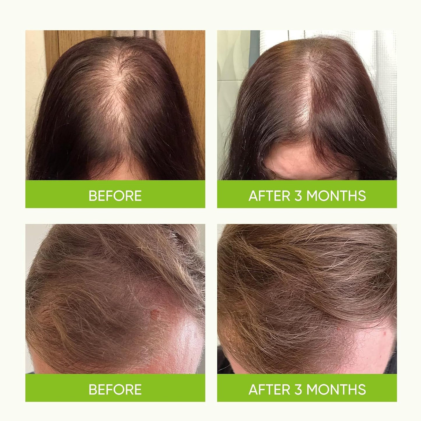 Svvimer Hair Growth Serum Spray - Rosemary & Biotin for Thinning Hair - Promotes Healthy Scalp & Fuller Hair | 2.7 fl oz