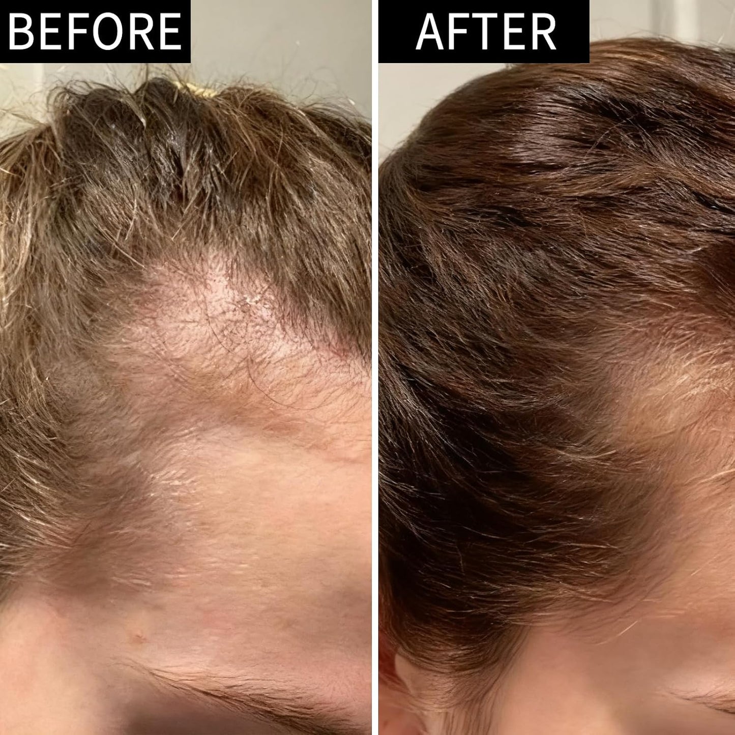 Hair Growth Serum - Biotin & Ginseng Treatment for Thinning Hair | Plant-Based Scalp Care Solution for Men & Women