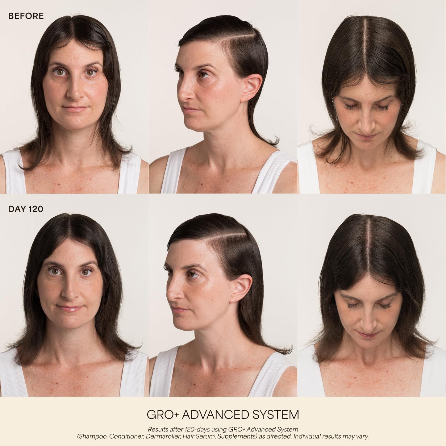 VEGAMOUR GRO+ Advanced Hair Serum for Improving Hair Density, Tonic Reduces Shedding and Promotes a Healthy Scalp, 30 Day Supply, 1 fl oz