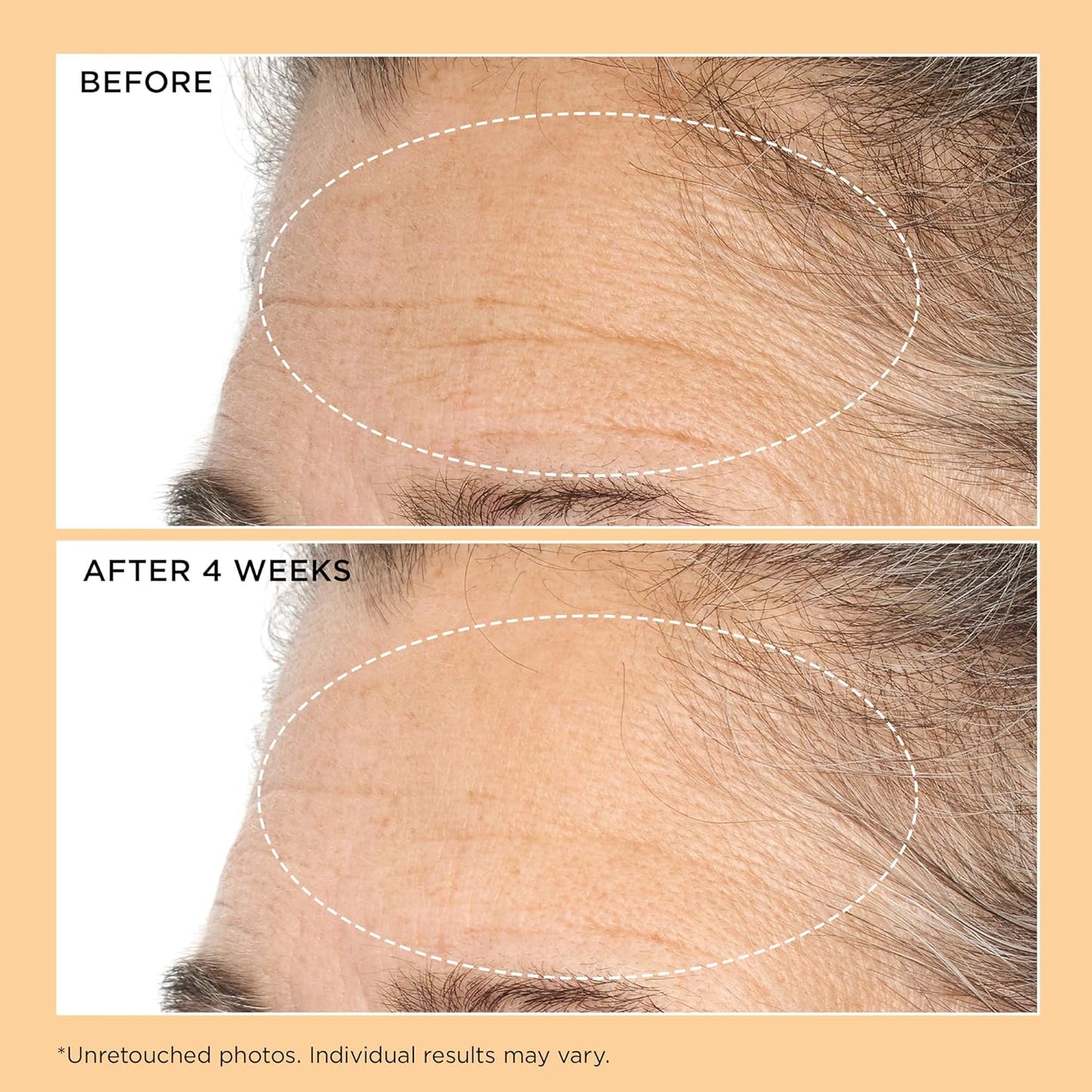 Perricone MD Neuropeptide Deep Crease Serum - Anti-Aging Formula | 1 fl oz