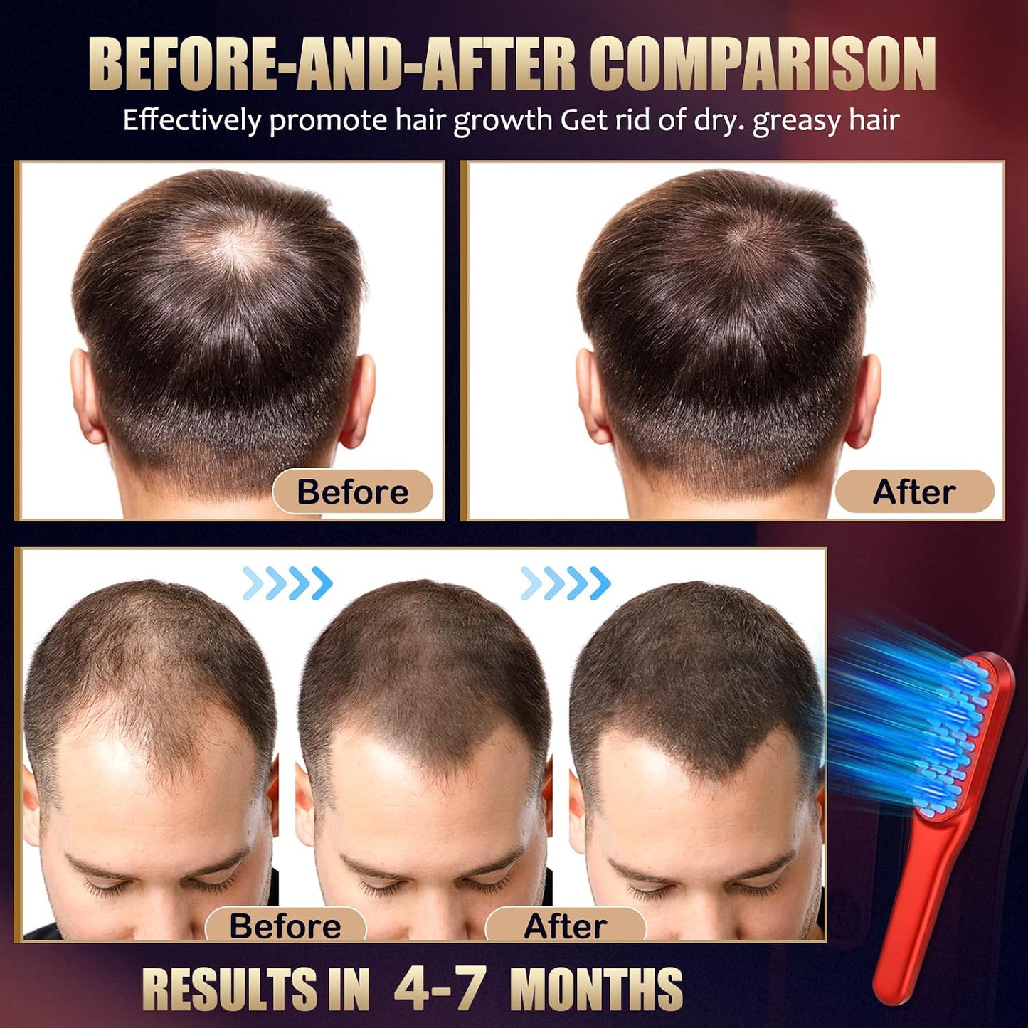 Laser Hair Growth Comb - Red Light Treatment for Men & Women | 1 Piece