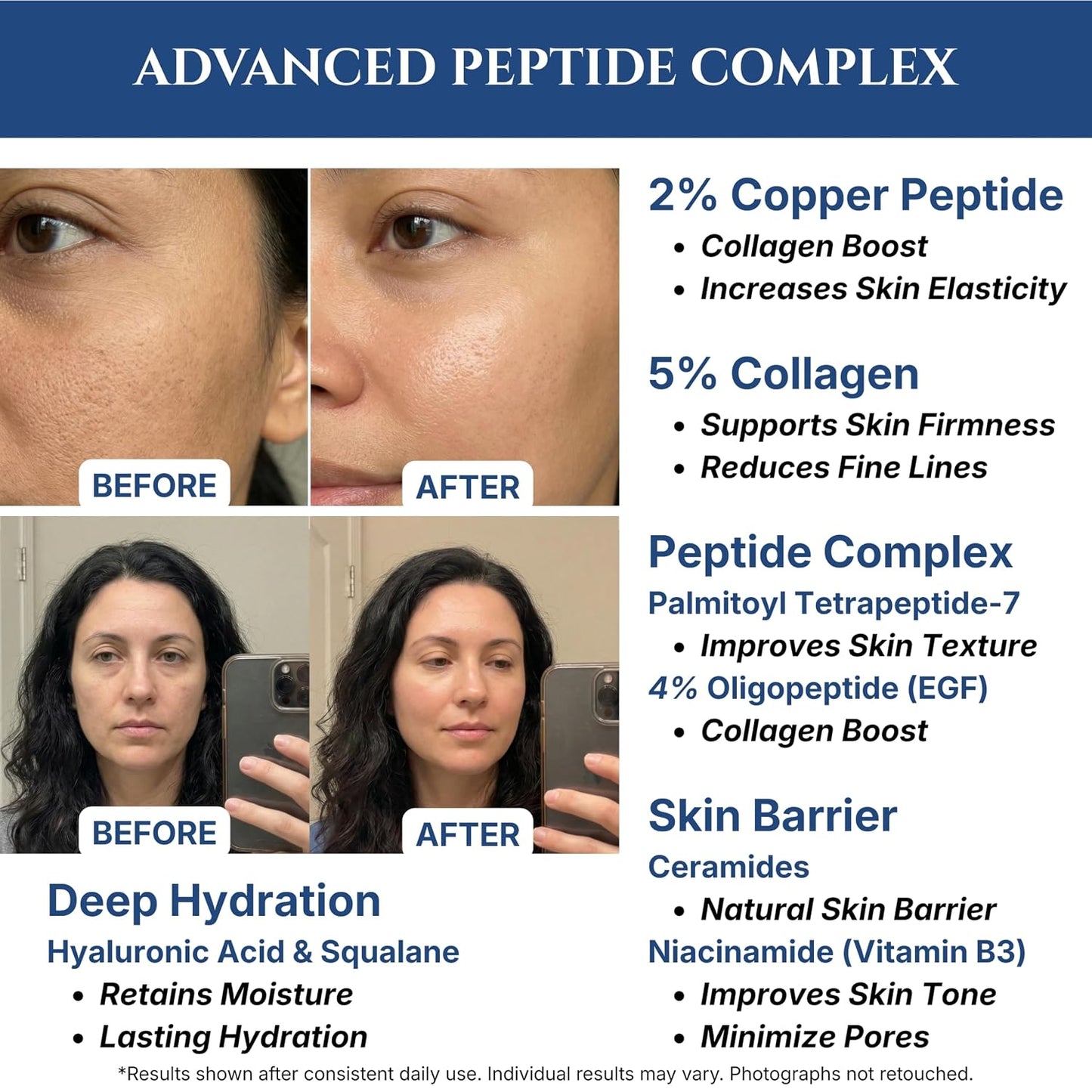 Copper Peptides Serum for Face - 2% Copper Peptide & 4% EGF, Niacinamide, Ceramides, Squalane | 1 fl oz