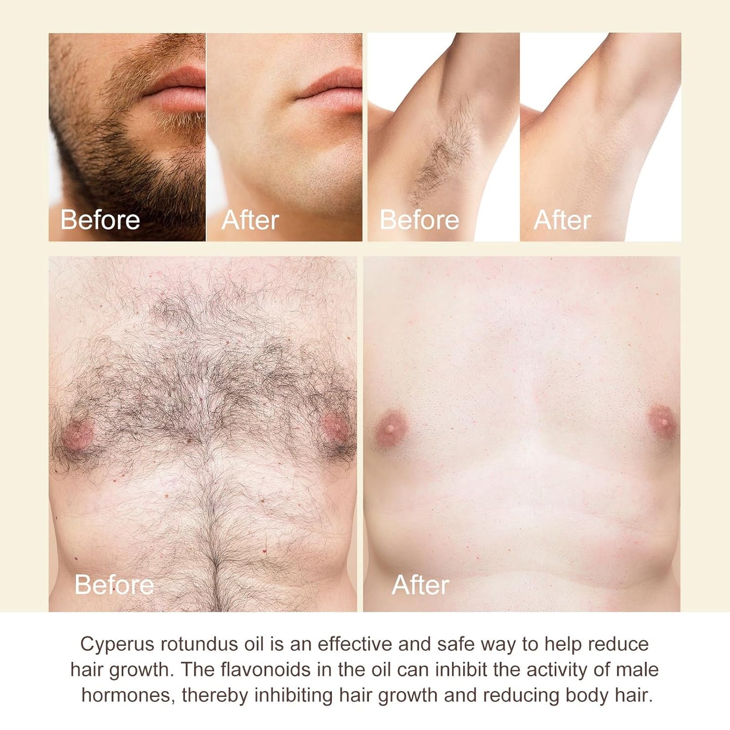 Cyprus Rotundus Oil - Natural Hair Removal Solution for Smooth Skin | 2.03 oz, All Skin Types