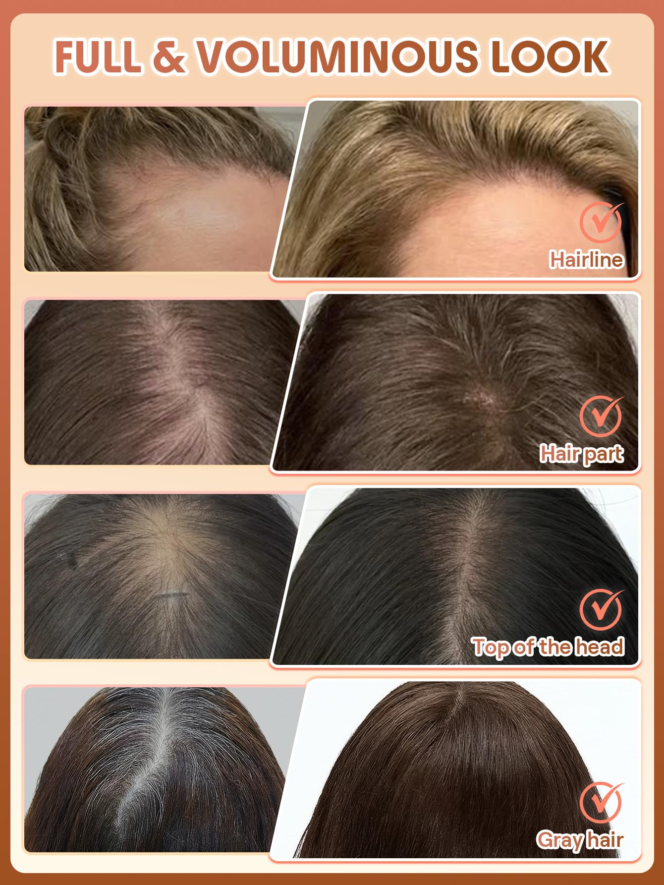 SHEGLAM Dark Brown Hair Building Fibers 15g, Volume Boost Hair Fiber Mist, Hair Thickening Powder for Thinning Hair, Instant Fuller Hairline, 72h Long Lasting for Men & Women(Applicator Not Included)