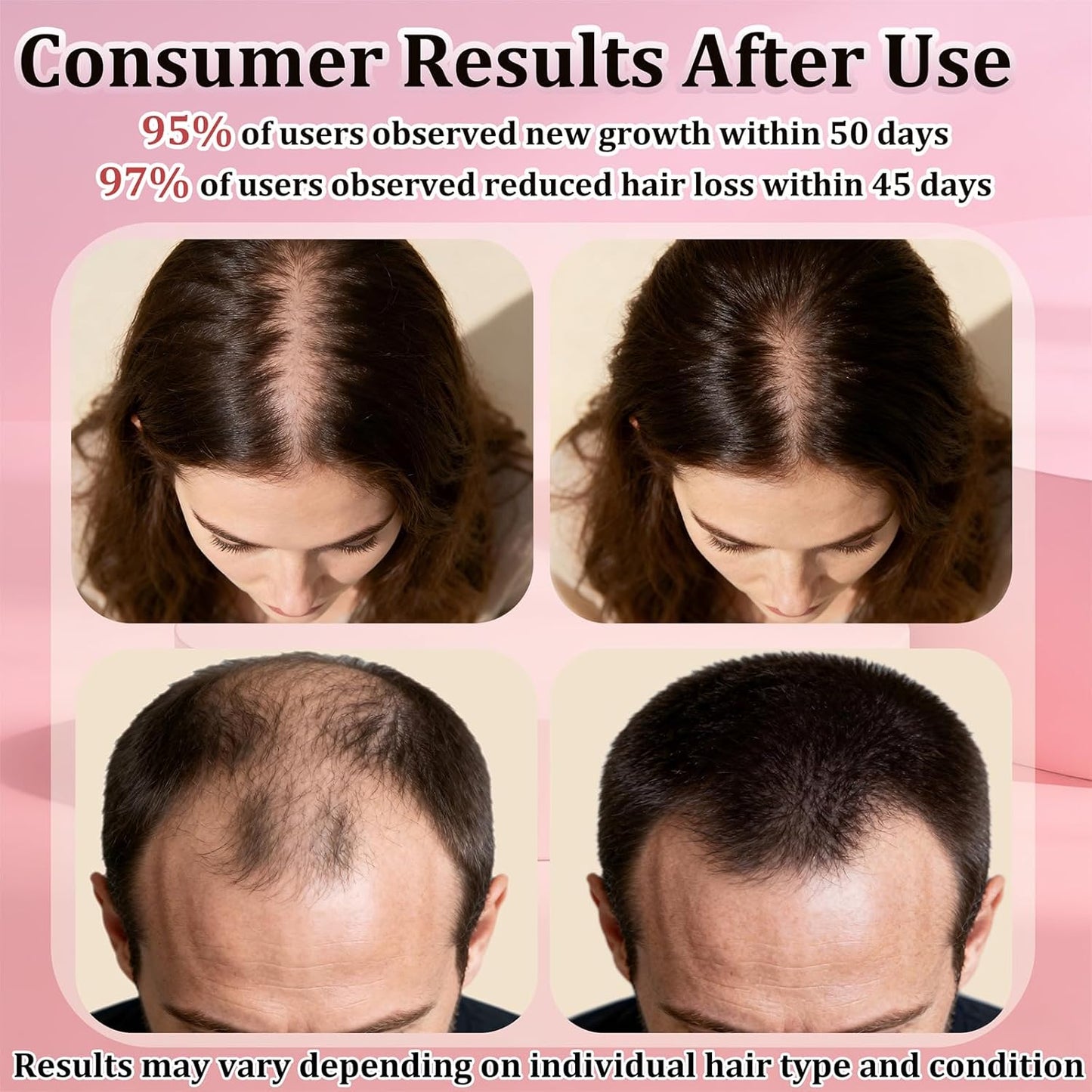 Minoxidil Spray for Hair Regrowth | Extra Strength Treatment with Biotin for Thinning Hair - 5 x 3.38 OZ (8-9 Month Supply)