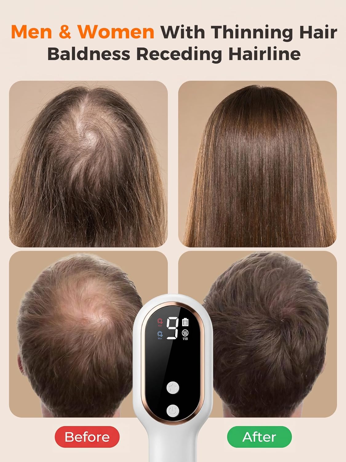 Red Light Therapy Device - 650Nm Cordless Laser Brush for Hair Growth | Portable Scalp Treatment for Men & Women