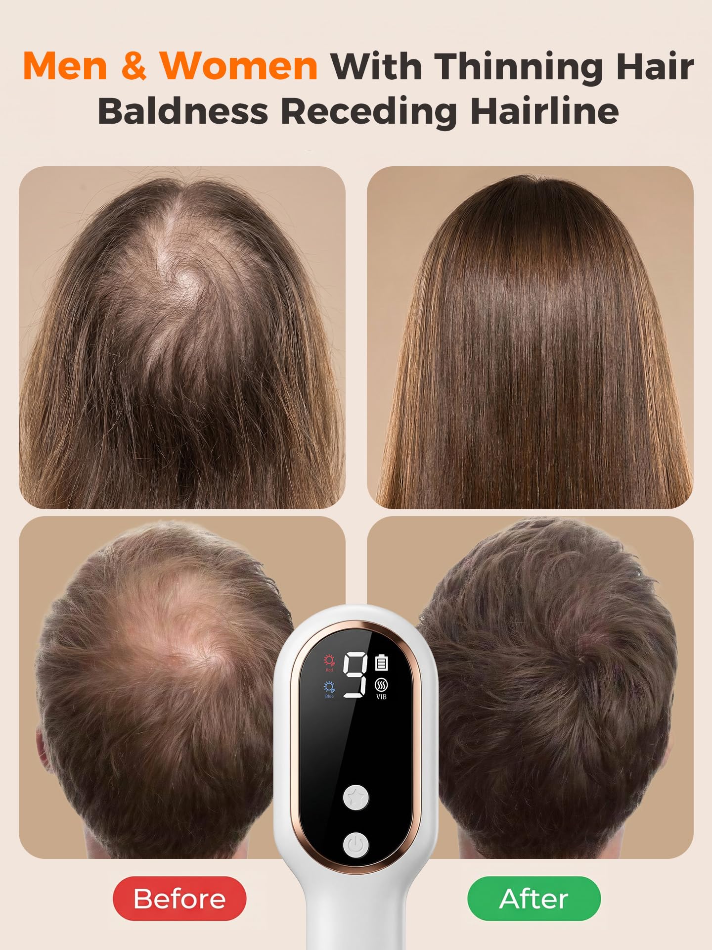 FDA-Device 650Nm LLLT Red Light Therapy For Hair Growth And Hair Loss, Cordless Handheld Scalp Laser Brush For Men & Women With Thinning Hair Baldness Receding Hairline, Portable Home Travel