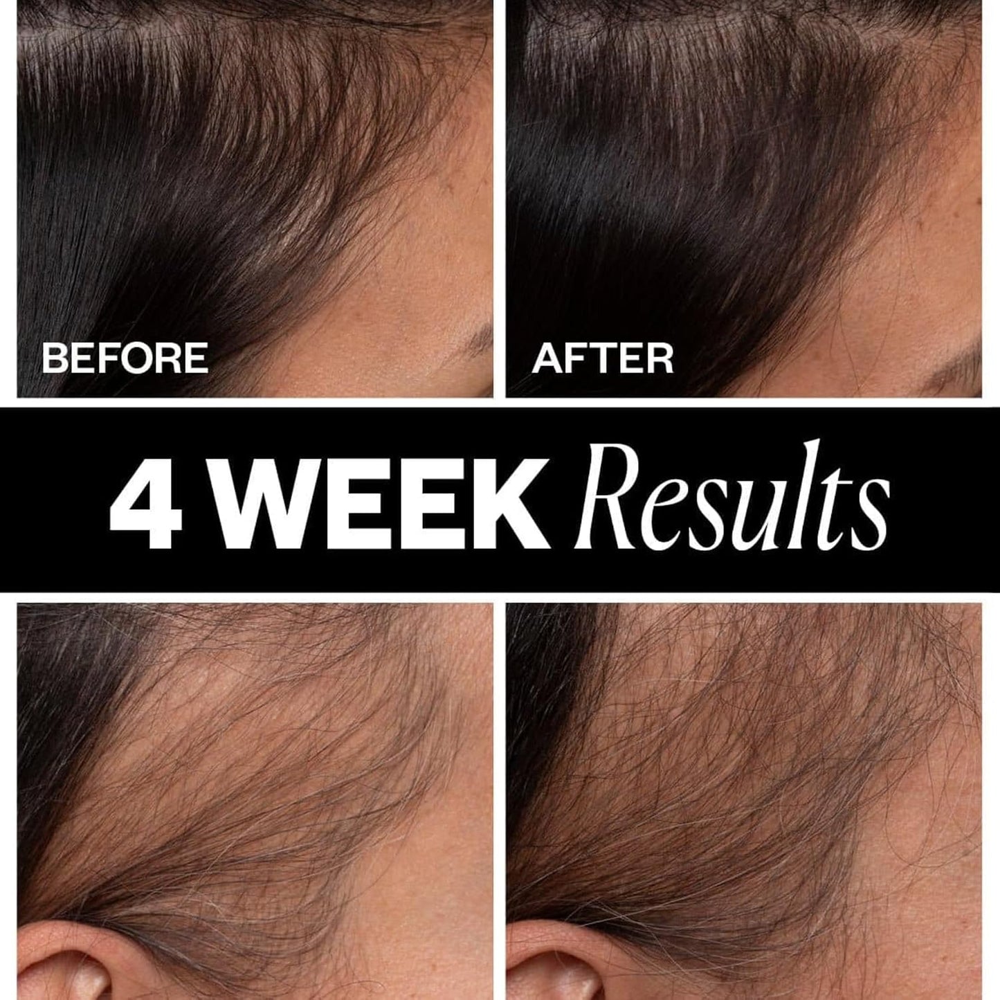 IGK Scalp Treatment for Hair Growth - Thickening Serum for Thinning Hair | Clinically Tested 2.1 Oz