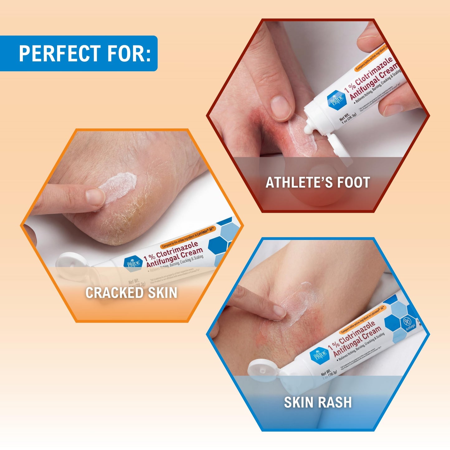 MED PRIDE Clotrimazole 1% Antifungal Cream, Itch Relief Treatment, 1 oz