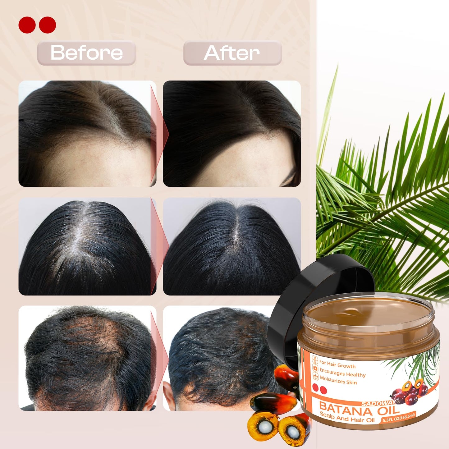 SADOWAY Batana Oil for Hair Growth: Batana Oil Organic for Hair Growth Prevent Hair Loss Moisturize Scalp for Men & Women