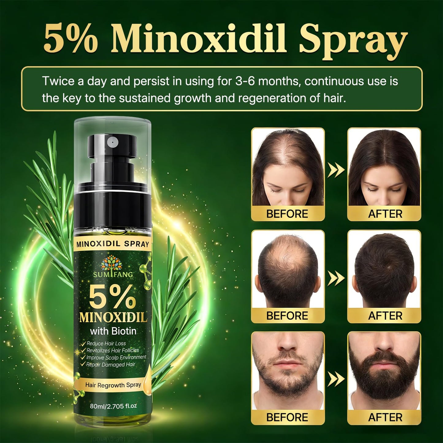 SUMIFANG 5% Minoxidil for Men & Women Hair Growth Biotin Serum with Rosemary for Hair Beard Regrowth Treatments, Unscented Topical Minoxidil Spray 80ML for Faster Stronger Thicker Hair Growth