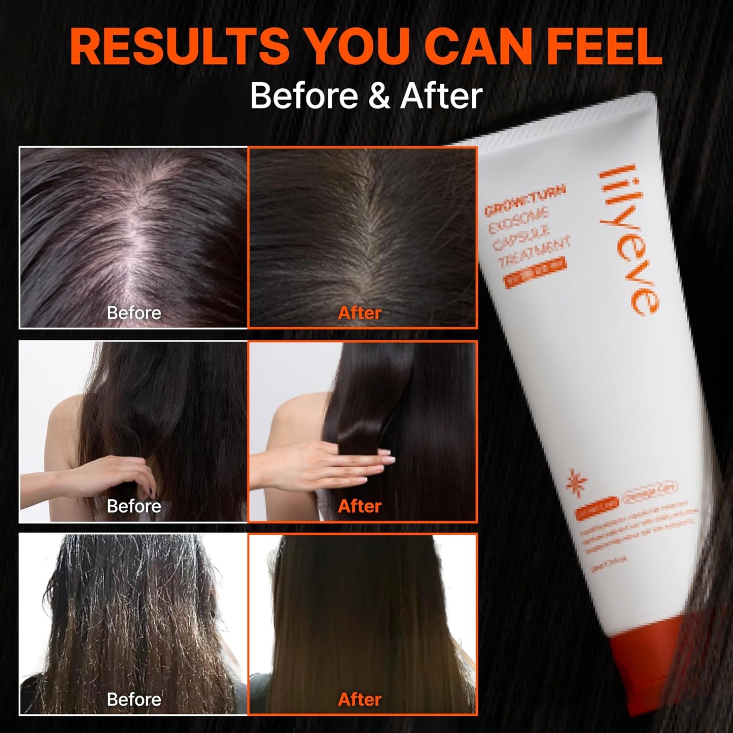 Lilyeve GROWTURN Hair Growth Treatment - Squalane Capsules & Exosomes | 7.77 fl. oz. Hair Mask for Damaged Hair