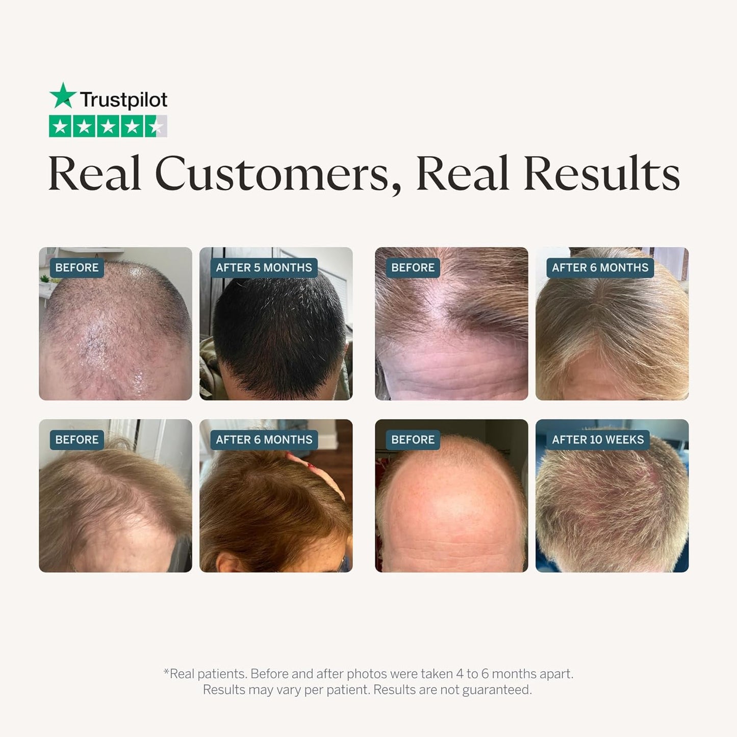 Happy Head Hair Serum - Procapil, Biotin & Collagen Formula for Daily Scalp Care | 2 Oz Bottle