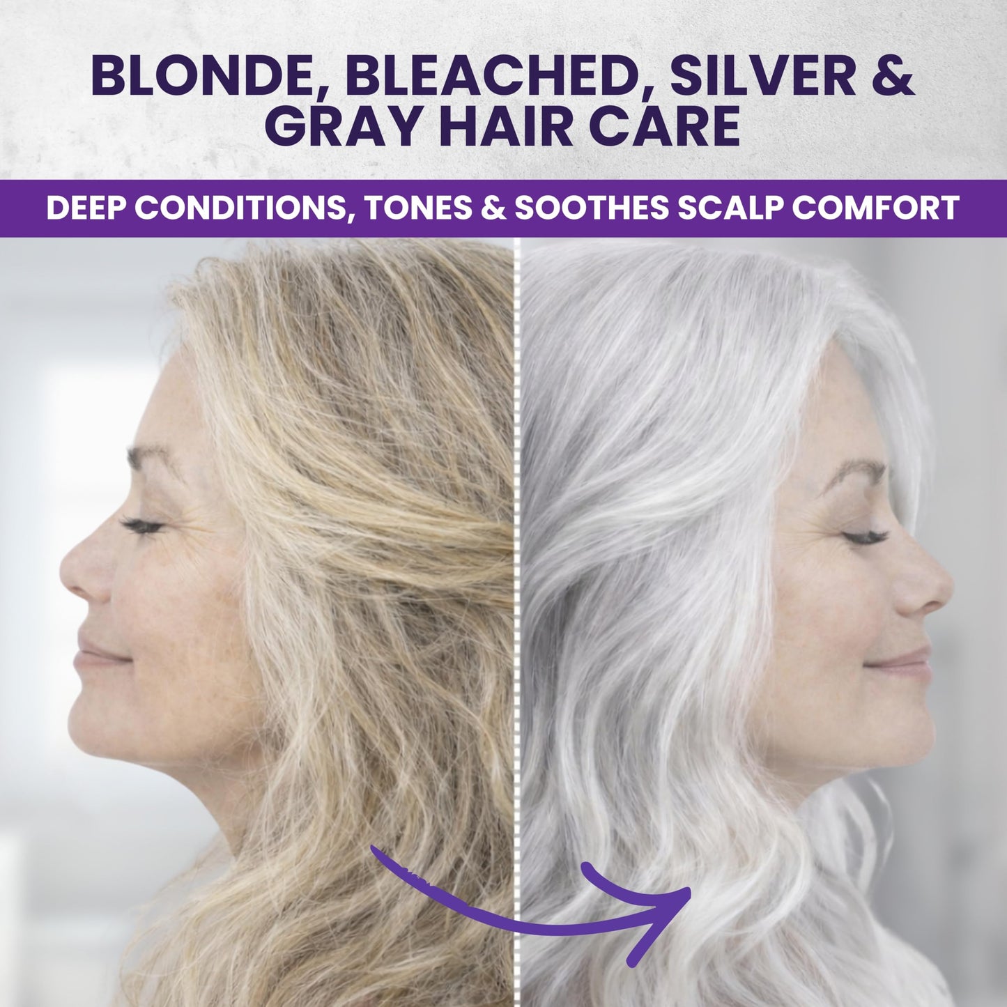 KESMEDIK Tea Tree Purple Hair Mask, Pure Silver Formula for Brassy Yellow Tones, Deep Conditioning with Tea Tree & Argan Oil for Dry Damaged Bleached, Blonde & Gray Hair, Flaky Itchy Scalp Care