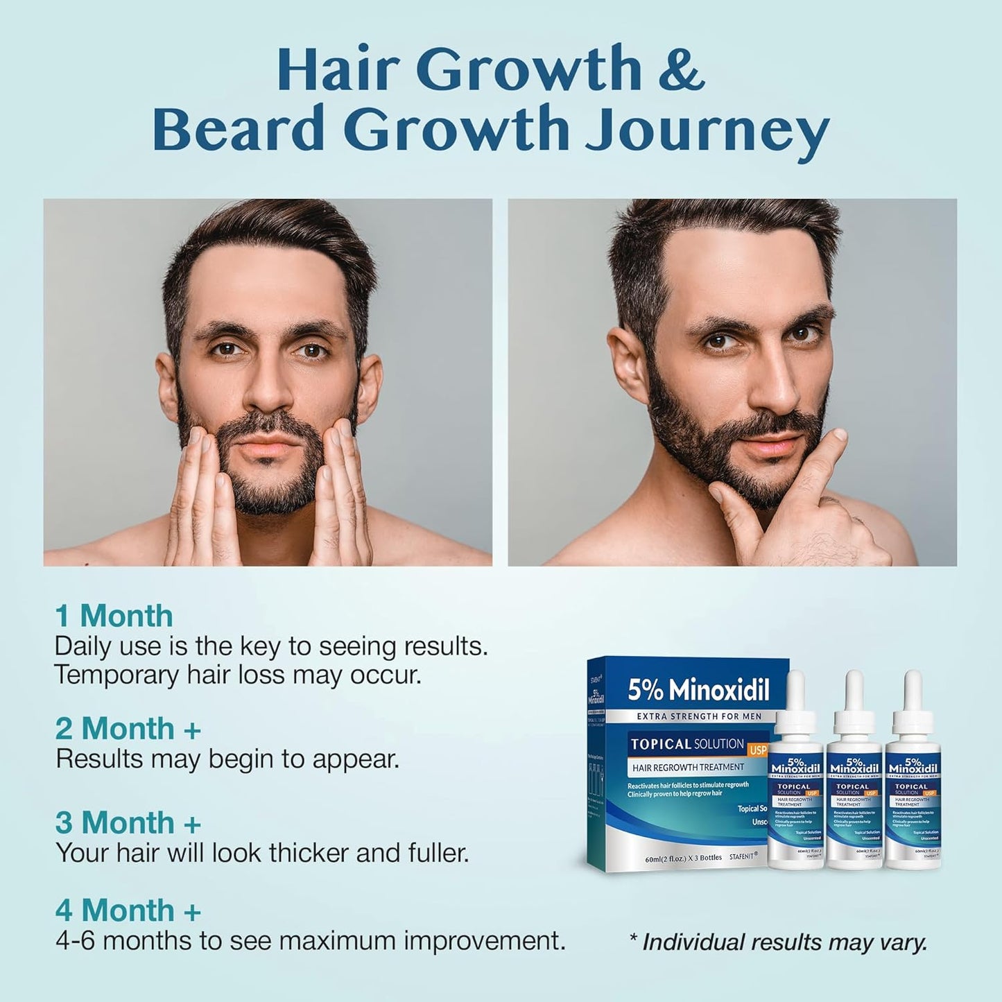 Minoxidil Hair Growth Serum - Extra Strength Beard Regrowth Treatment with Biotin | 60ml, 3 Bottles
