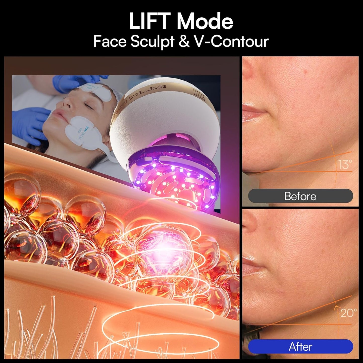 INIA SPHERA 8-in-1 Microcurrent Facial Device - Red Light & Cooling Tool for At-Home Skin Care | 5 Custom Modes