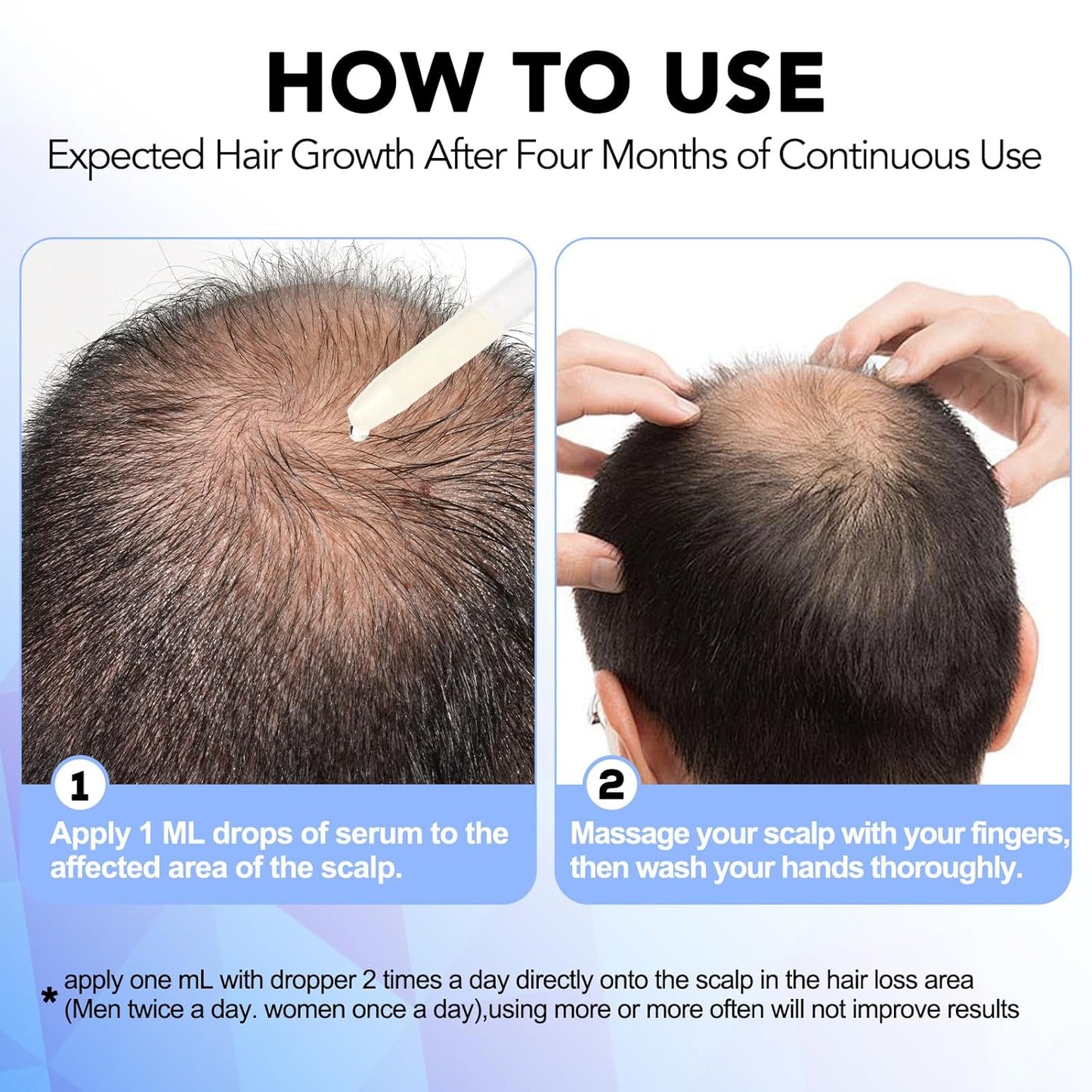 Minoxidil for Men - 5% Extra Strength Hair Regrowth Treatment | Topical Solution with Dropper Applicator
