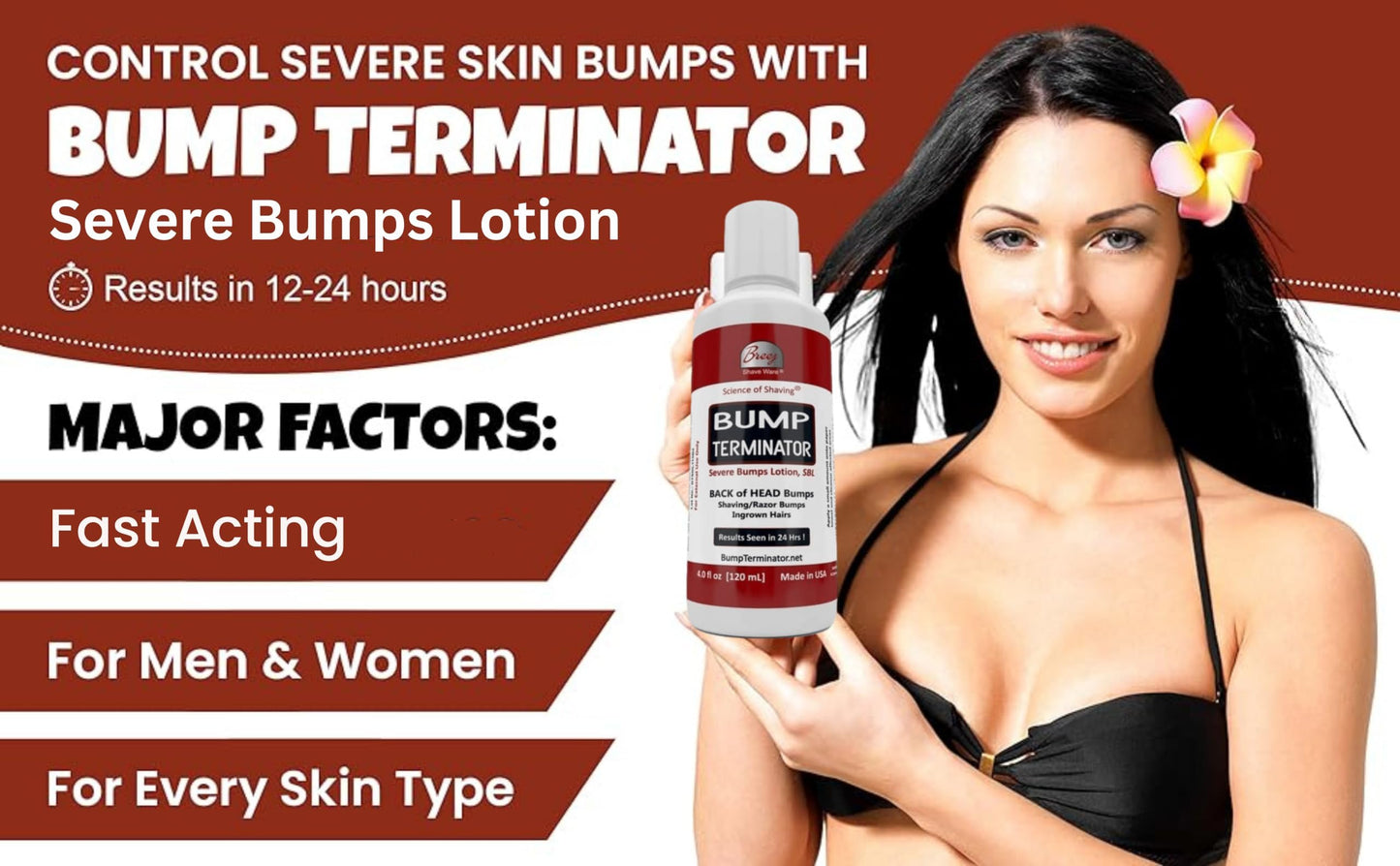 BUMP TERMINATOR Severe Bumps Treatment | Razor Bumps And Ingrown Hair Treatment | Bikini Bumps | Back of Head Bumps And Ingrown Hair Treatment, 4 oz. (Pack of 1)