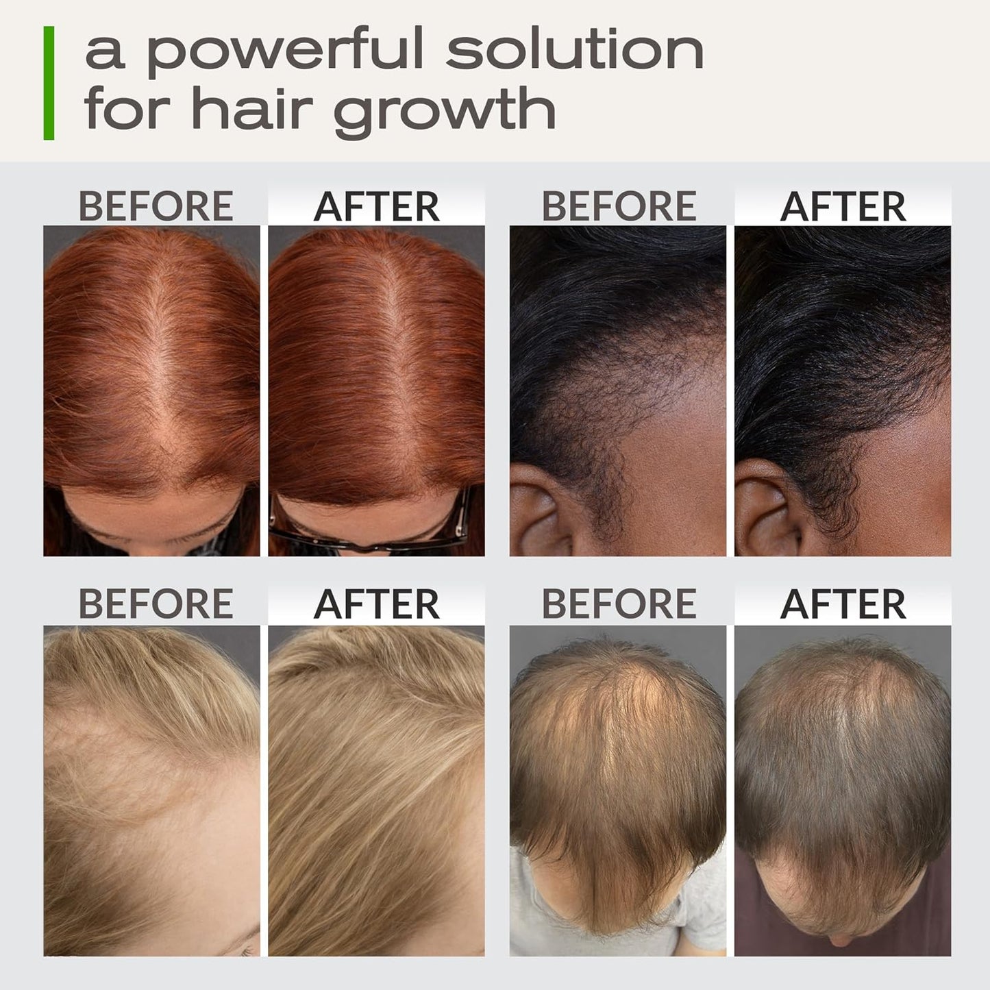 Hair Growth Oil - Rosemary, Castor & Peppermint Oils with Biotin - Dry Scalp Treatment | 2 Fl Oz Glass Bottle