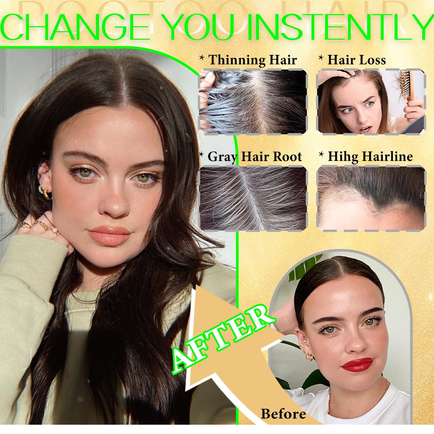 Hair Toppers for Women - Real Human Hair 14 Inch Clip-In Scalp Pieces | Dark Brown, 360° Coverage