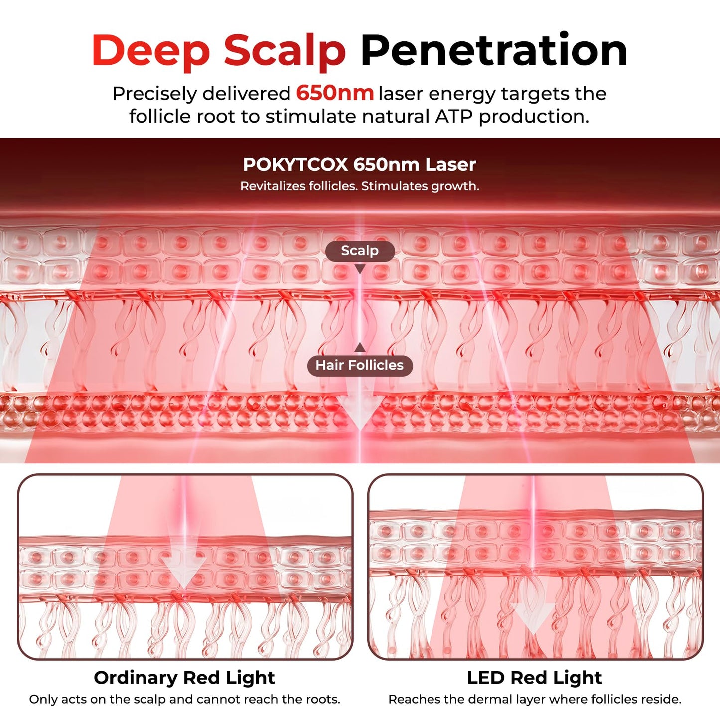 Laser Red Light Therapy for Hair Growth,FDA Cleared Hair Growth Device for Men & Women,650nm Low Level Laser Therapy for Thinning Hair & Alopecia, 200 Lasers Full Scalp Coverage Home Use(KCA451-200S)